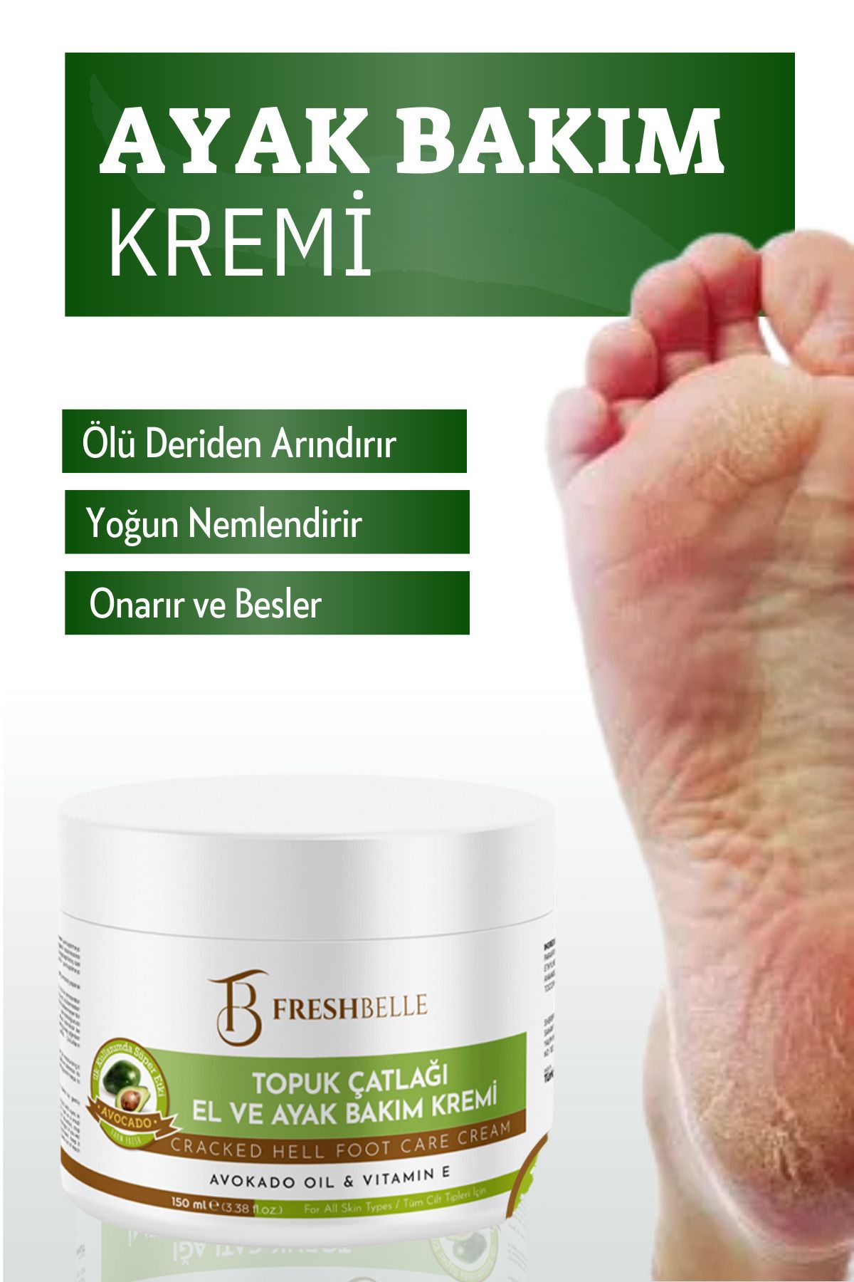 Ayak, Topuk, Çatlak, Mantar, Koku, Ve Diyabetik Yaralar Için Nemlendirici Bakim Kremi