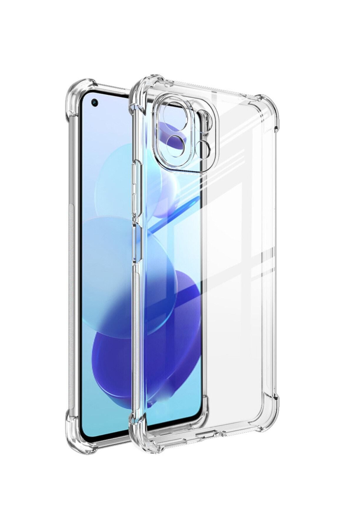 Di Aksesuar Köşe Korumalı Antishock Airbag Xiaomi Mi 11 Lite