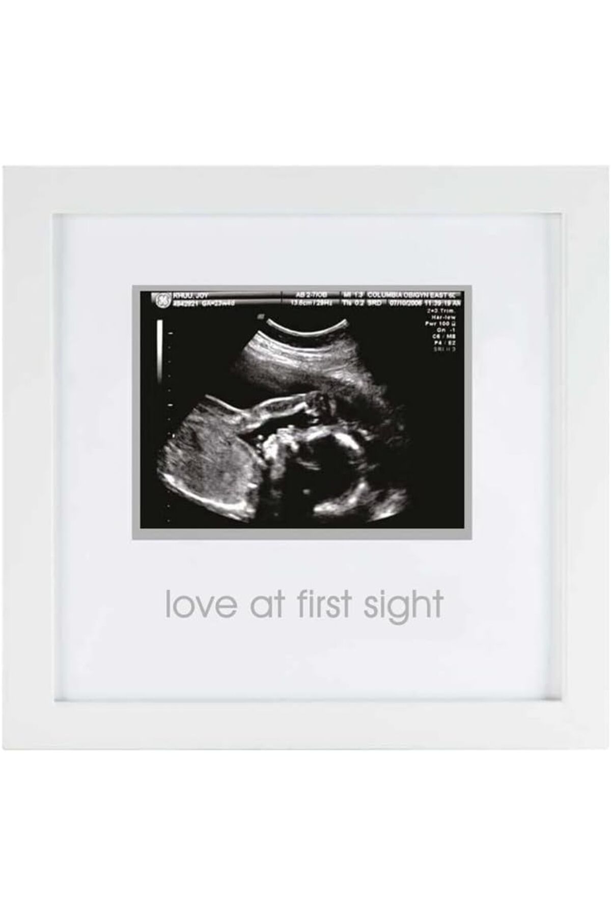 STOREMAX İlk Görüşte Aşk Sonogram Resim Çerçevesi, Hamilelik Hatırası Fotoğraf Çerçeves