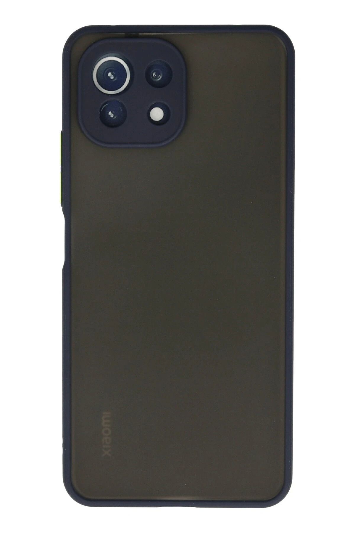 NewFace Xiaomi Mİ 11 Lite Kılıf Montreal Silikon Kapak - Lacivert YNSMR