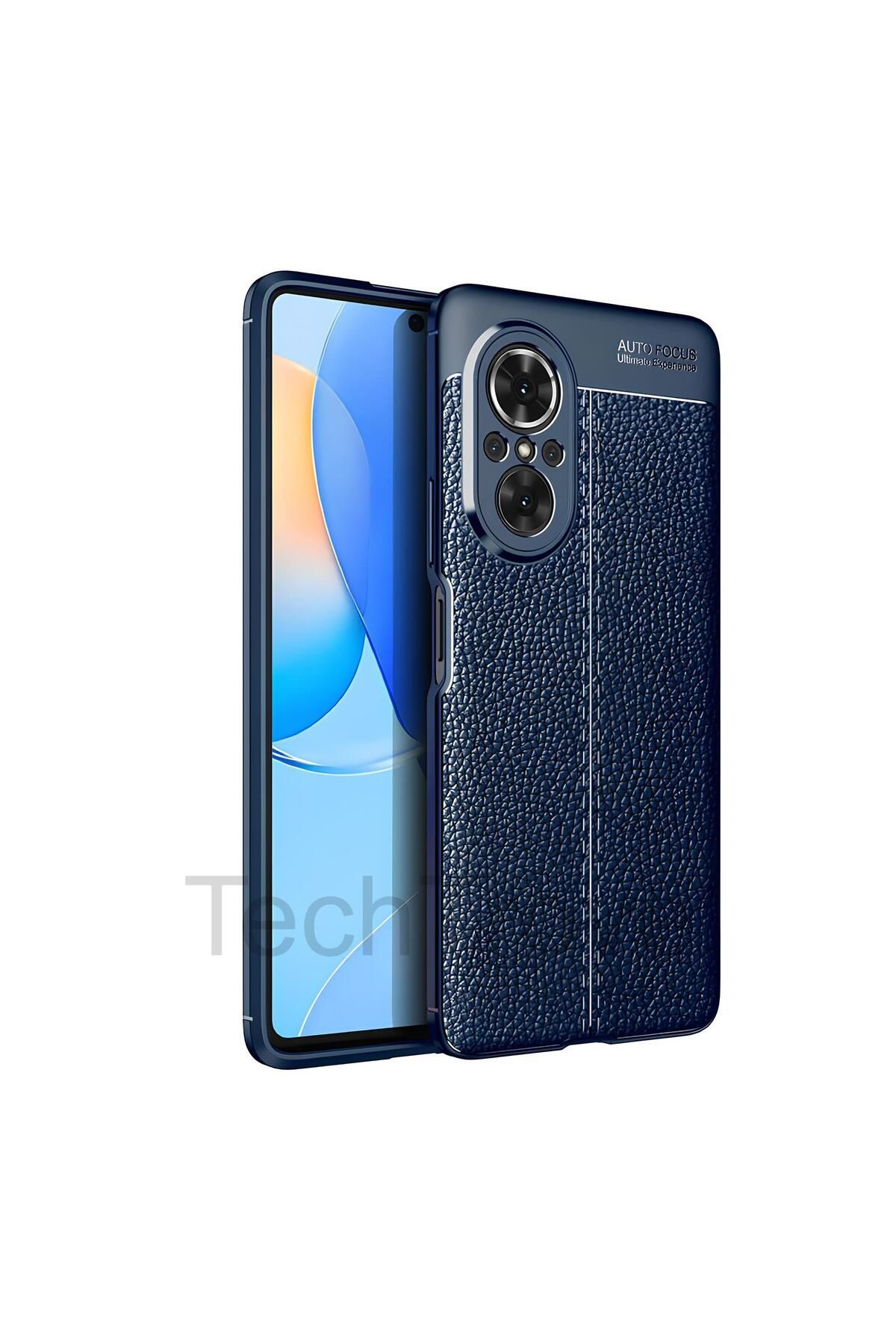 TechTrove Huawei Nova 9 SE Kılıf Deri Extra Korumalı Slikon Kapak