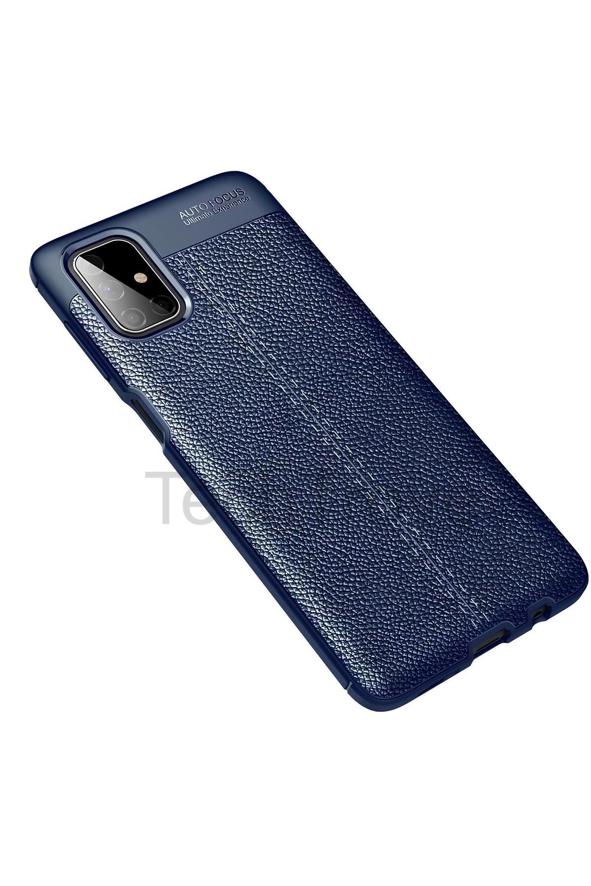 TechTrove Samsung Galaxy M51 Kılıf Deri Extra Korumalı Slikon Kapak