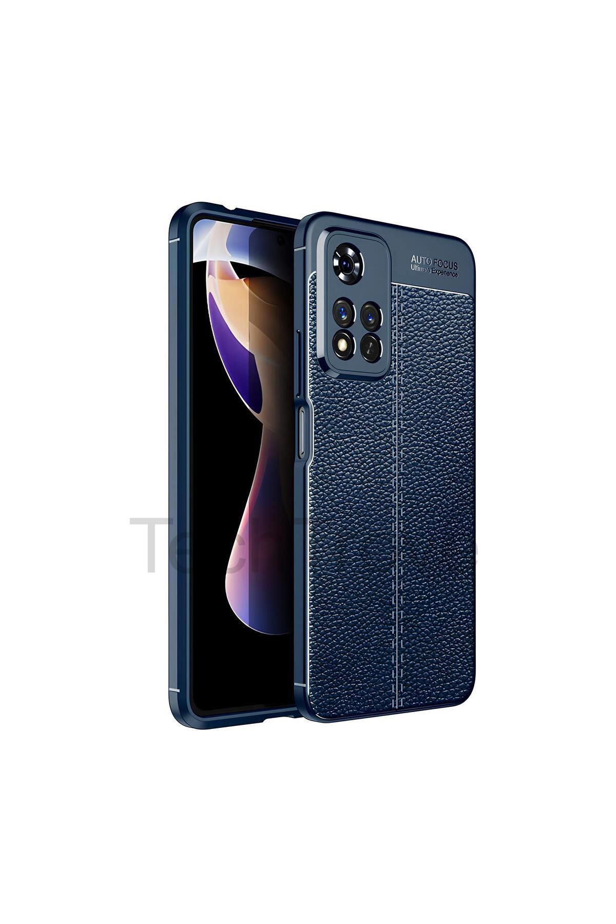 TechTrove Xiaomi Redmi Note 11 Pro 5G Kılıf Deri Extra Korumalı Slikon Kapak