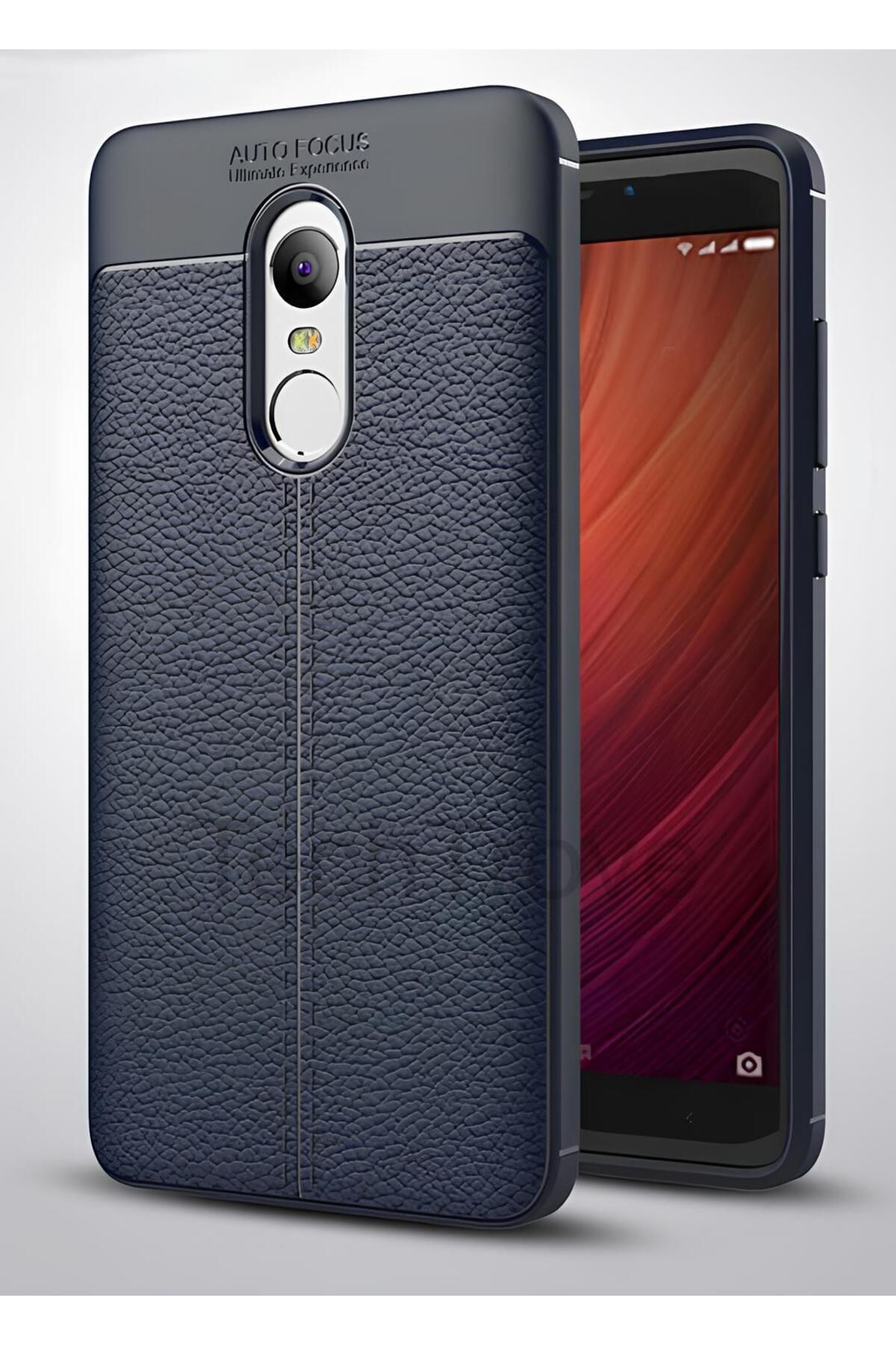 TechTrove Xiaomi Redmi Note 4x Kılıf Deri Extra Korumalı Slikon Kapak