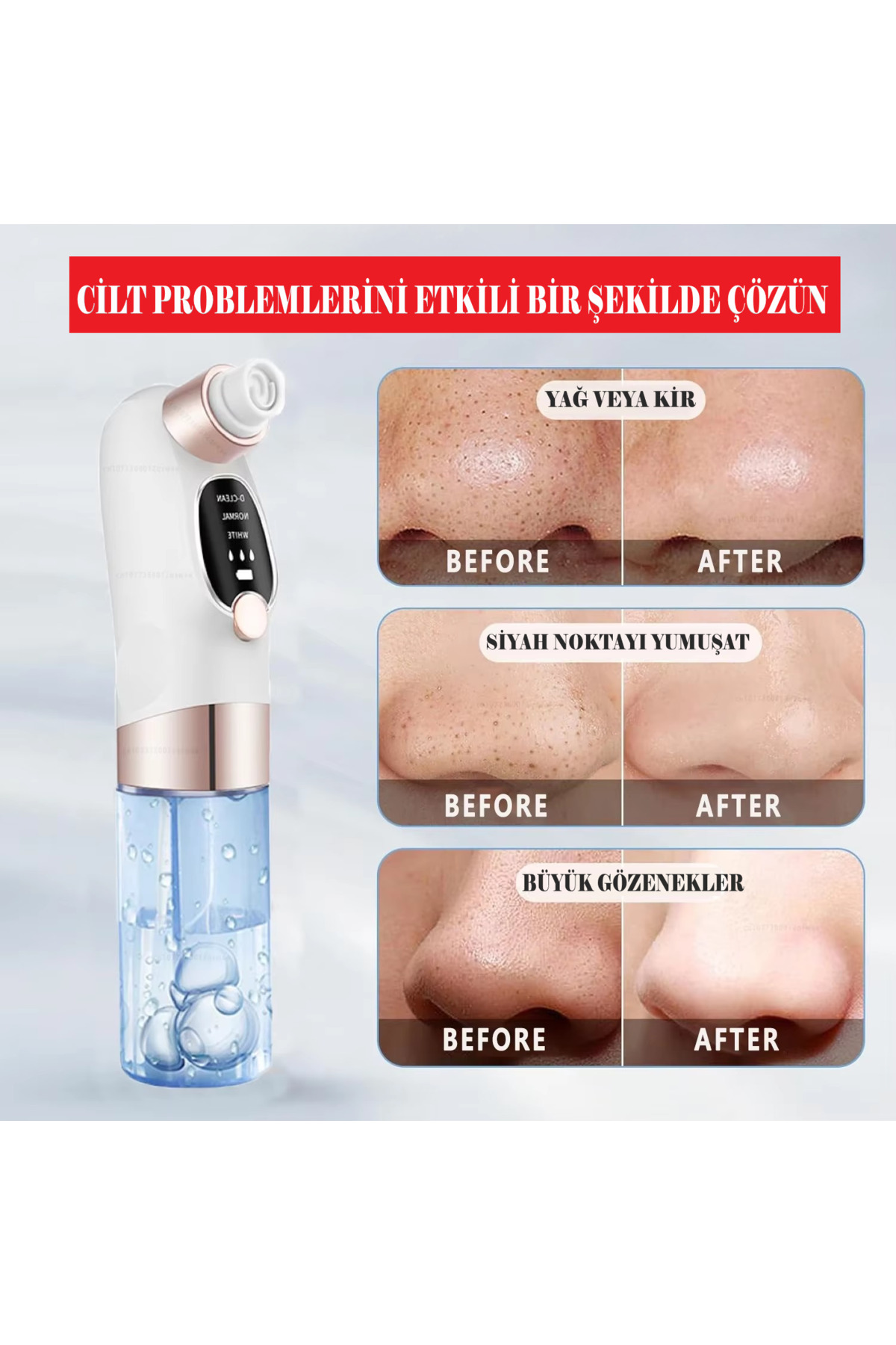 جاروبرقی پاک کننده صورت بر پایه آب، دستگاه رفع جوش سرسیاه و صورت، قابل شارژ، با 6 ویژگی مختلف سر — flawlessuluVAKUM — تصویر 2 از 4