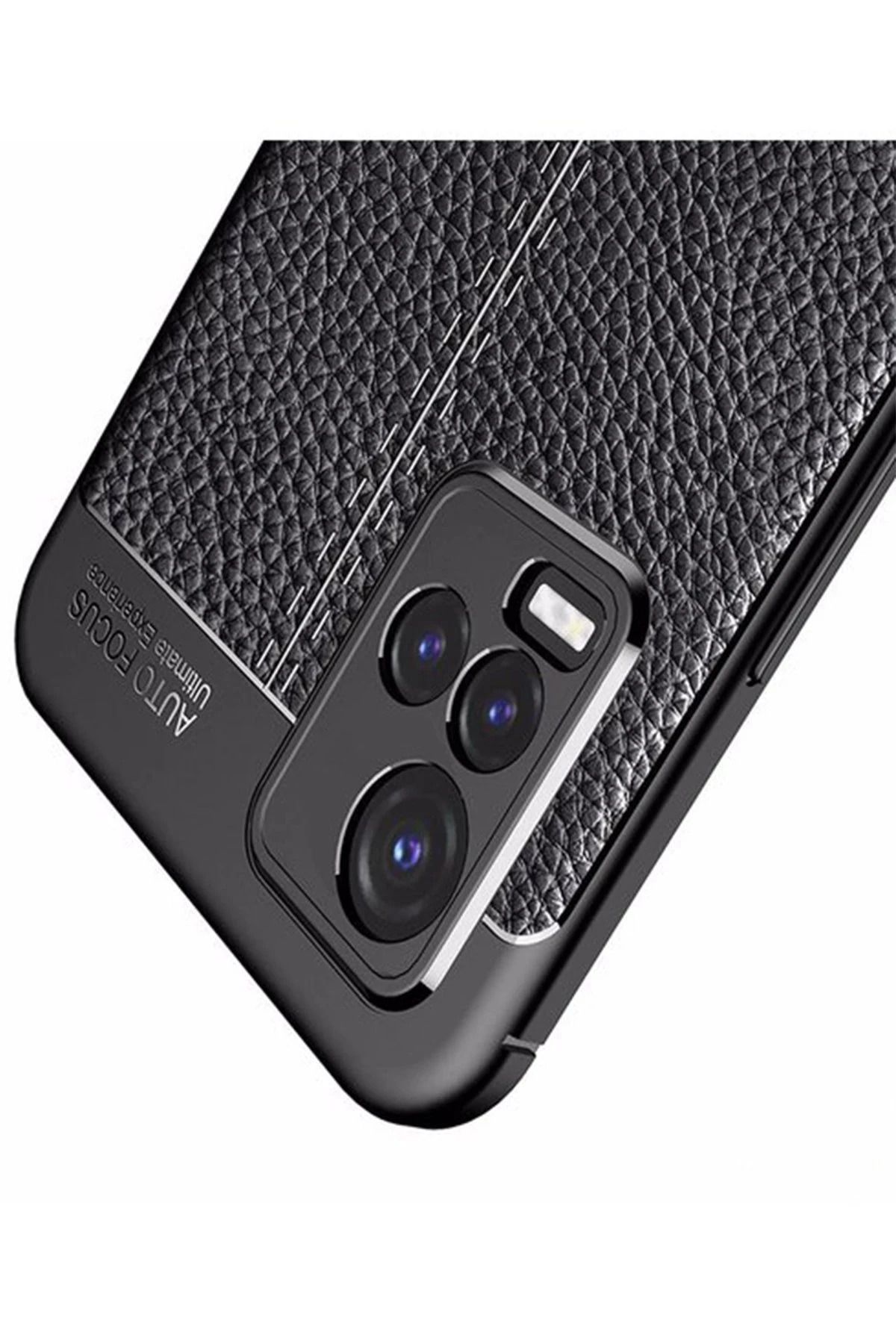 NewFace Vivo Y21S Kılıf Auto Focus Kapak - Siyah NRMSA