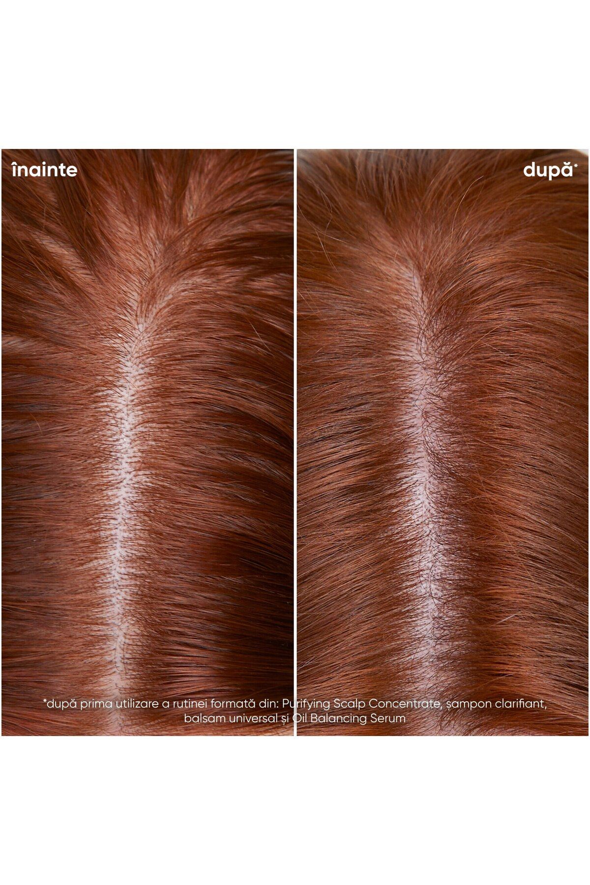Biolage-Biolage Scalp Sync Clarifying Shampoo with Glycolic Acid and Fermented Tea Extract 5