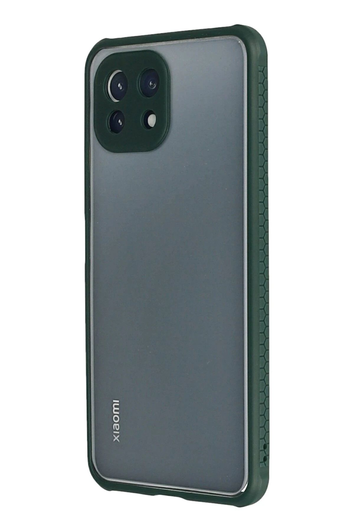 NewFace Xiaomi Mİ 11 Lite Kılıf Miami Şeffaf Silikon - Koyu Yeşil GLSTD