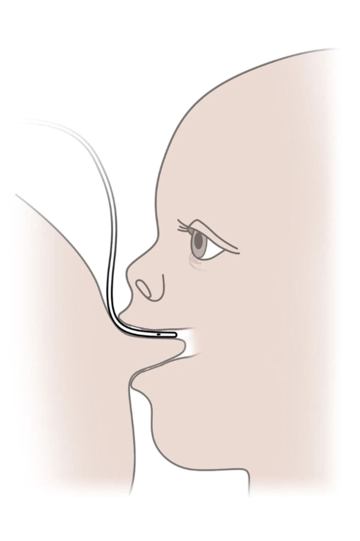 Bıçakçılar-Breastfeeding Support System No:8, Blue Nutrition Probe, Fixing Tape and Locked Injector 2