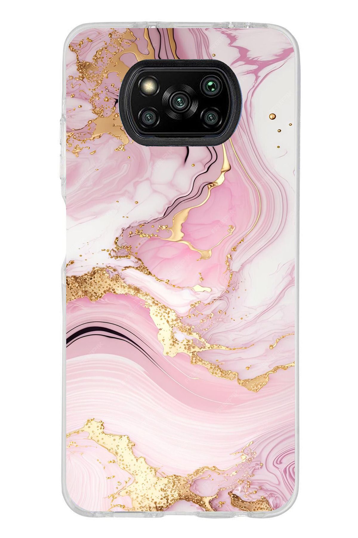 TechTree Poco X3 / NFC / PRO Uyumlu Pembe Mermer Şeffaf Silikon Kılıf