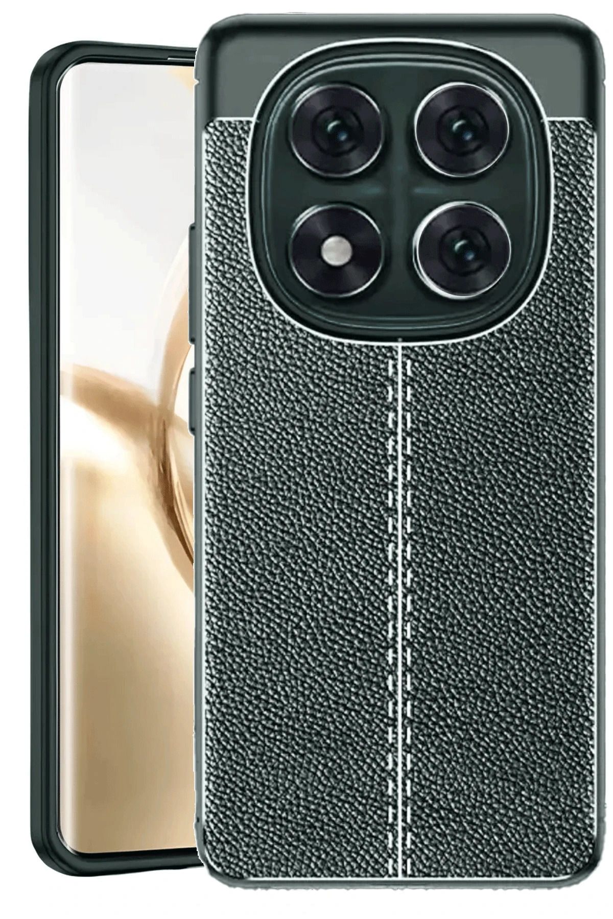Posso Xiaomi Redmi Note 14 Pro 4G Kılıf Deri Dikiş Tasarım Ultra Dayanıklı Slim Fit Esnek Kapak