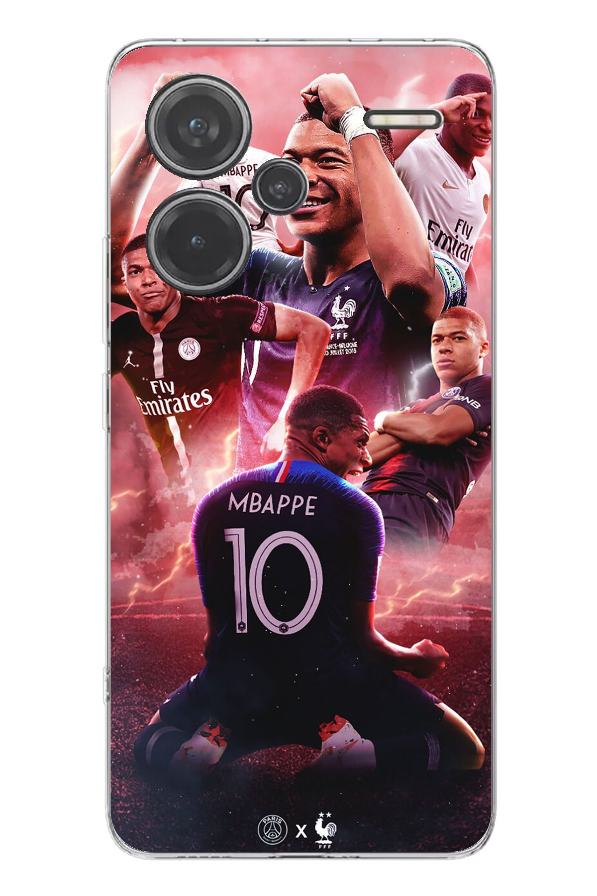 TechTree Redmi Note 13 PRO PLUS 5G Uyumlu Mbappe Sevinçler Şeffaf Silikon Kılıf