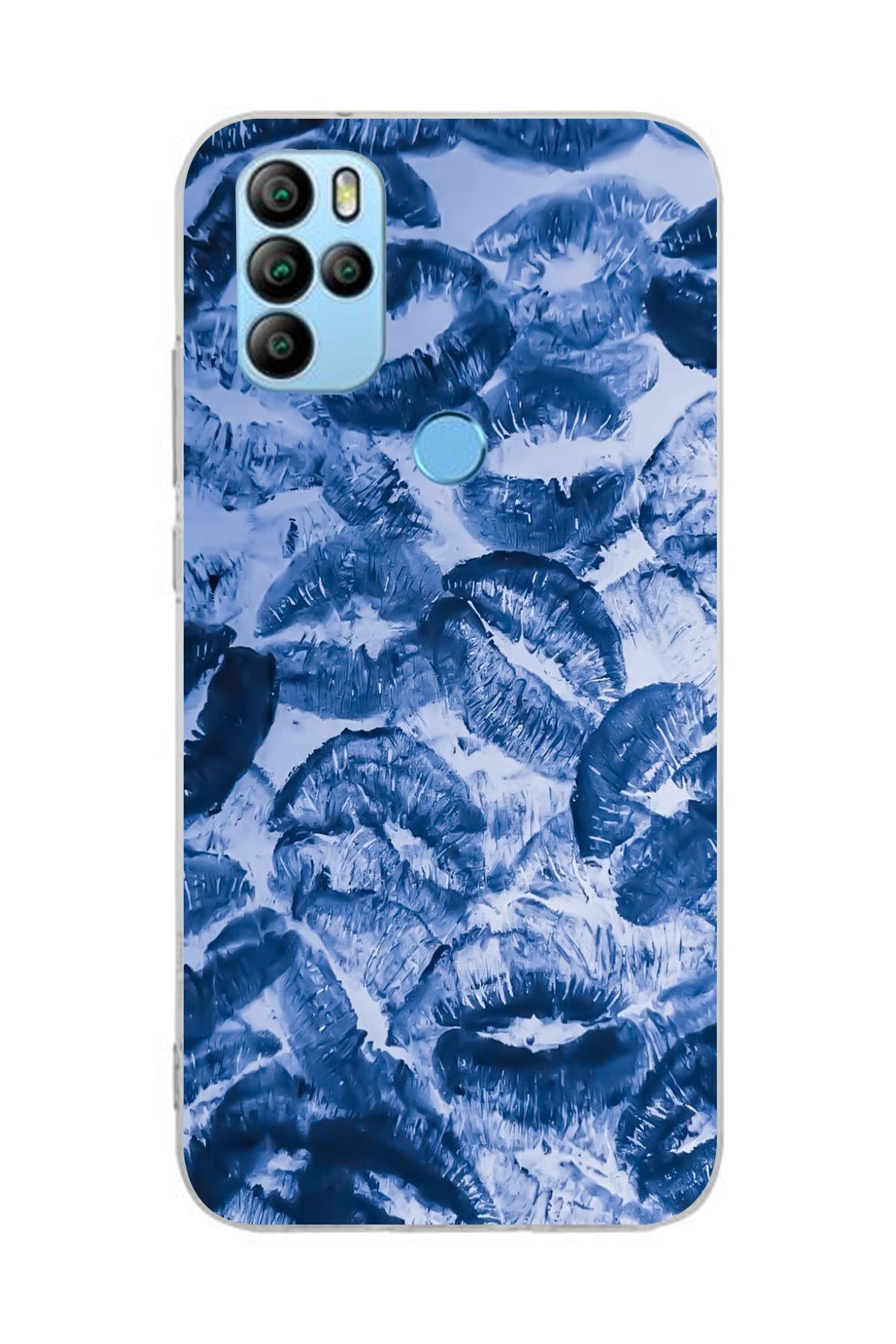 moonset Omix X300/X500 Uyumlu Mavi Dudaklar Tasarımlı Baskılı Şeffaf Telefon Kılıfı