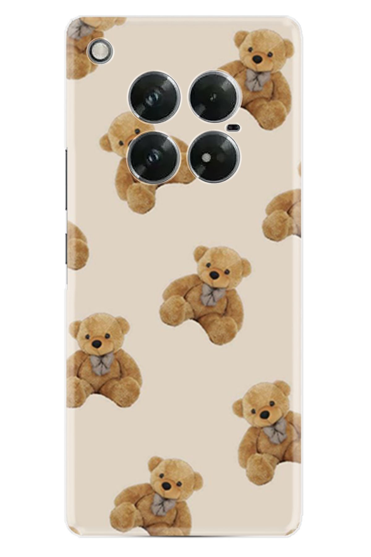 Arvencase Infinix Zero 40 Kılıf HD Baskılı Kılıf Yüksek Korumalı - /Özel Seriler/- name-81.jpg