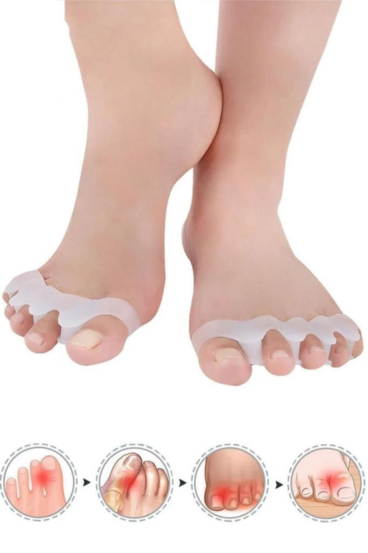 Pisicik Makara Ayak 5 Parmak Ayıran Silikon Bunyon Koruyucu Parmak Ayırıcı Gece Ateli 1 Çift