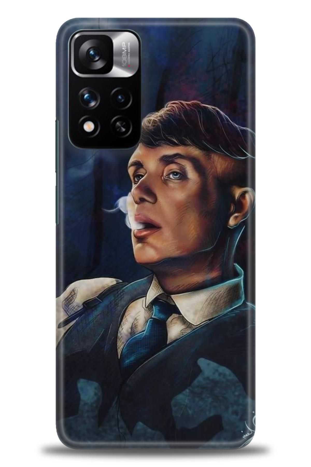 CooperTech Xiaomi Redmi Note 11 Pro Plus İle Uyumlu HD Baskılı Desenli Silikon Kılıf - 940