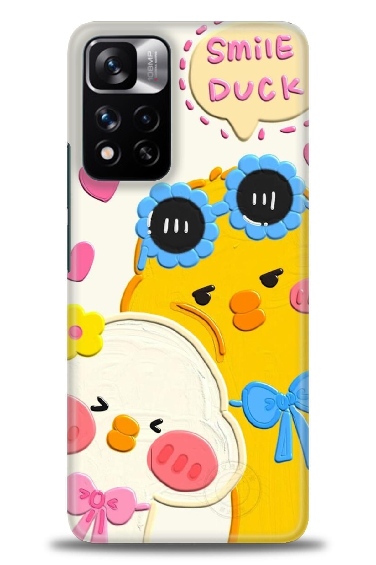 CooperTech Xiaomi Redmi Note 11 Pro Plus İle Uyumlu HD Baskılı Desenli Silikon Kılıf - 831