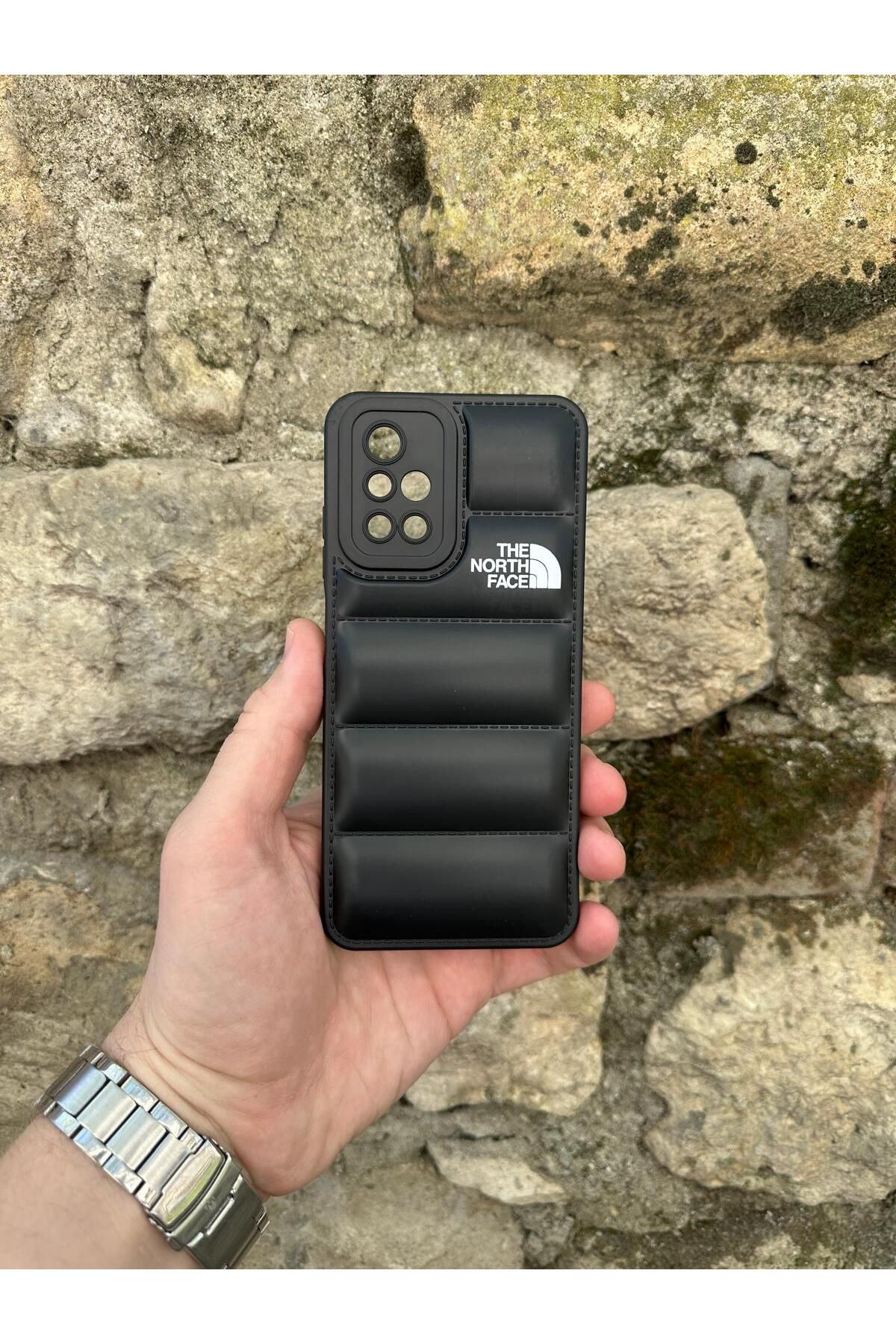 YZGOLDEN XIAOMI REDMİ 10 UYUMLU PUFFER CASE TELEFON KILIFI