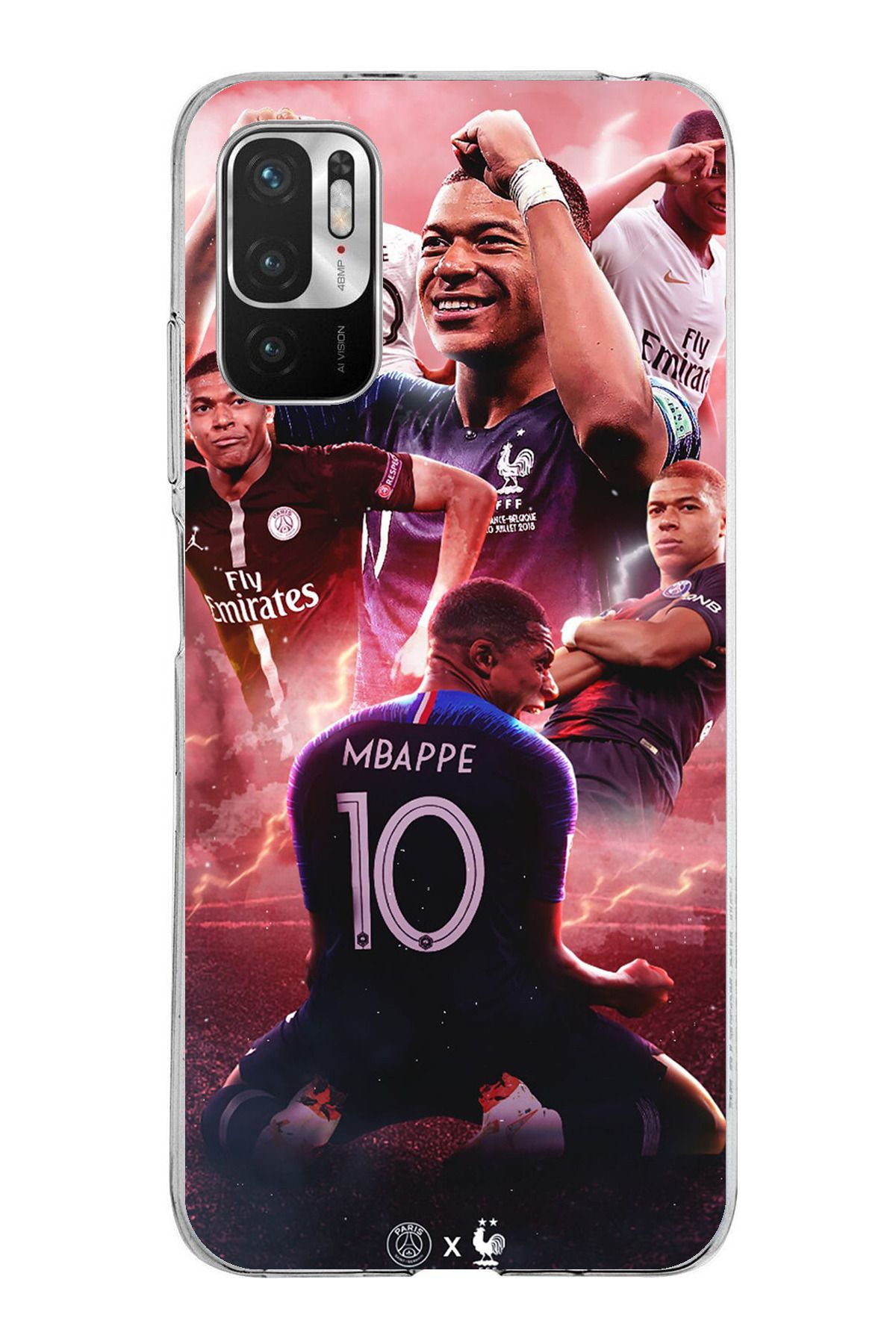 TechTree Redmi Note 10 5G Uyumlu Mbappe Sevinçler Şeffaf Silikon Kılıf