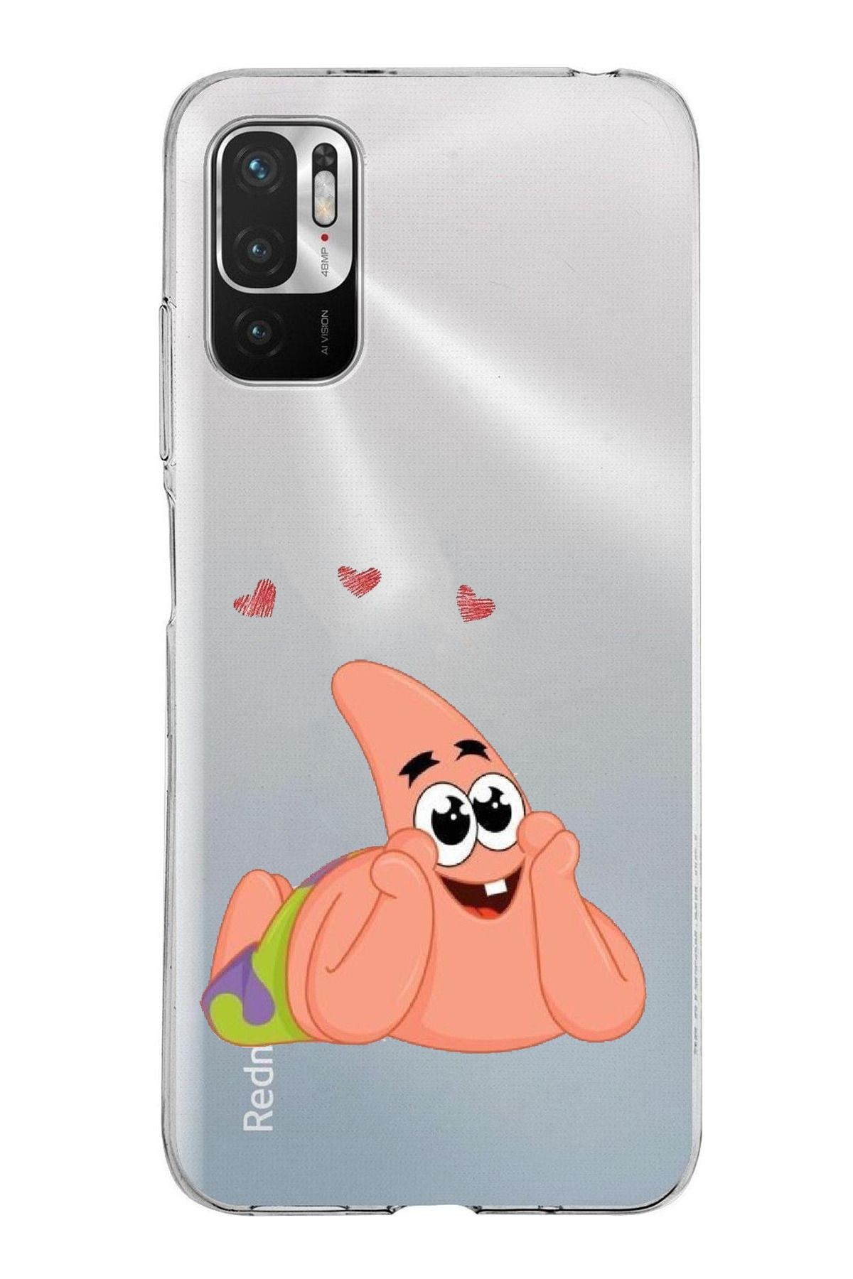 TechTree Redmi Note 10 5G Uyumlu Patrick Yıldız Aşk Tasarımlı Şeffaf Silikon Kılıf