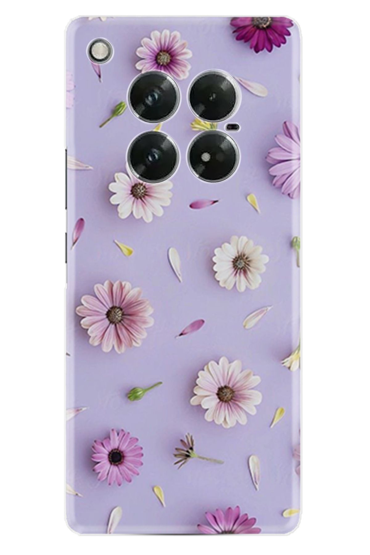 Arvencase Infinix Zero 40 Kılıf HD Baskılı Kılıf Yüksek Korumalı - /Özel Seriler/- name-11.jpg