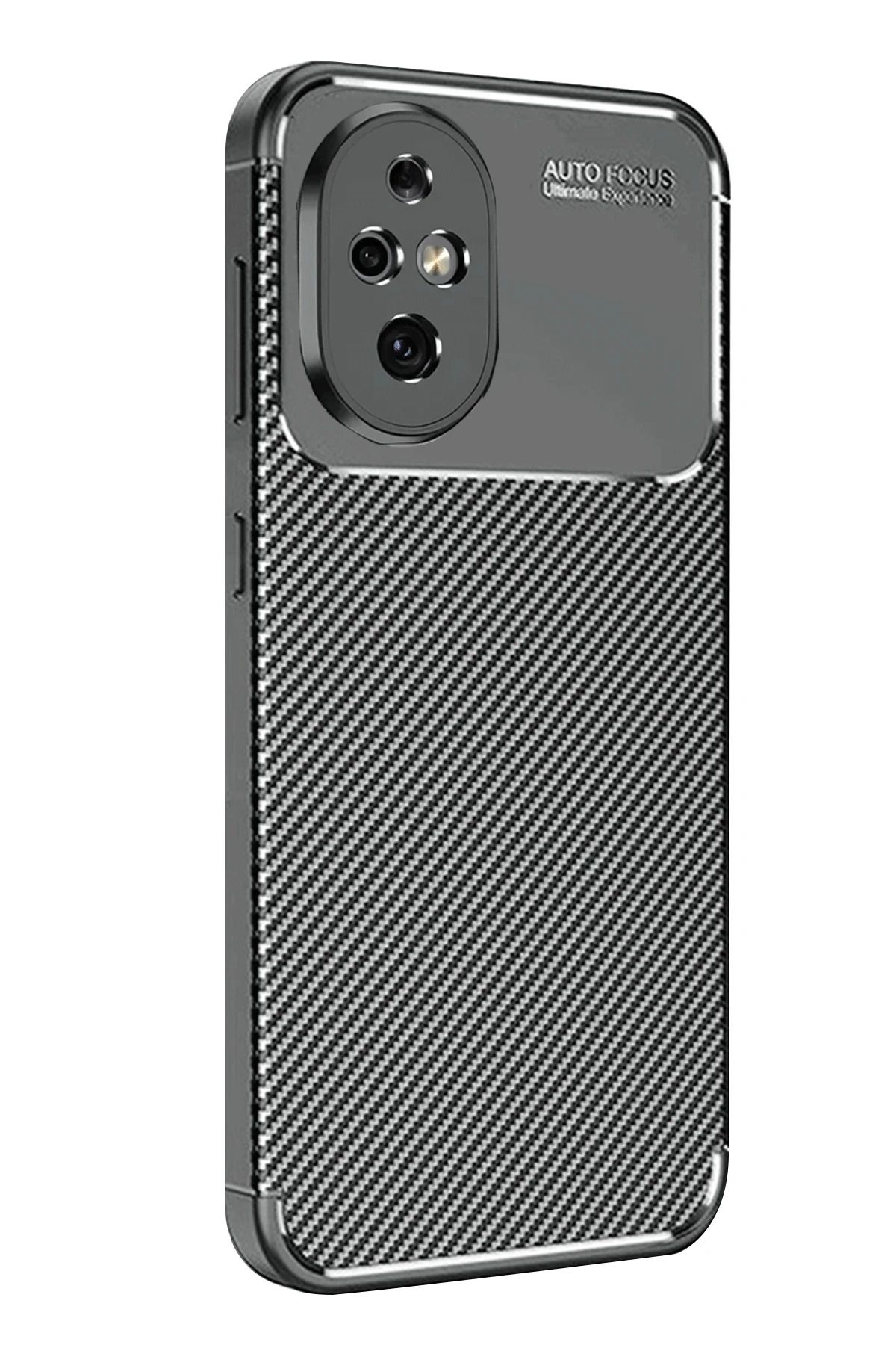 NewFace Honor 200 Kılıf Auto Focus Karbon Kapak - Siyah MRAYD