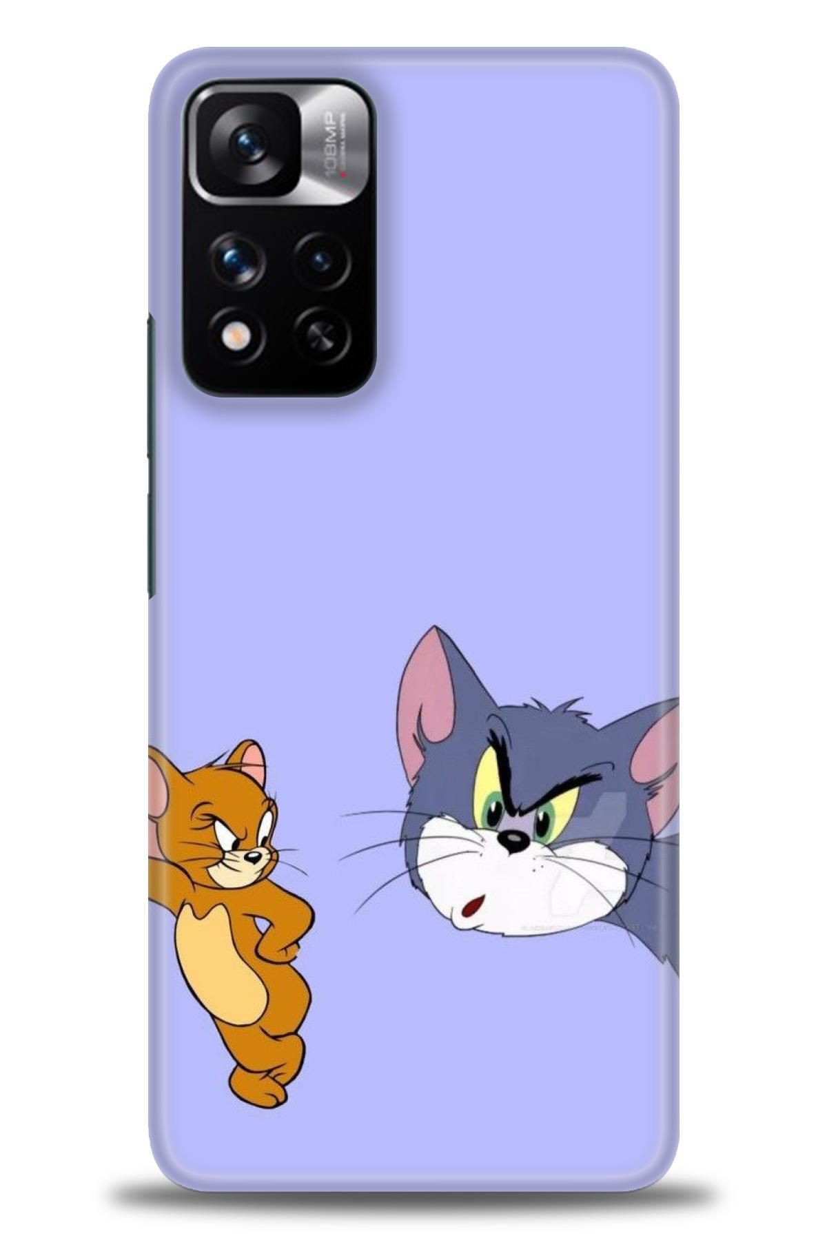 CooperTech Xiaomi Redmi Note 11 Pro Plus İle Uyumlu HD Baskılı Desenli Silikon Kılıf - 970
