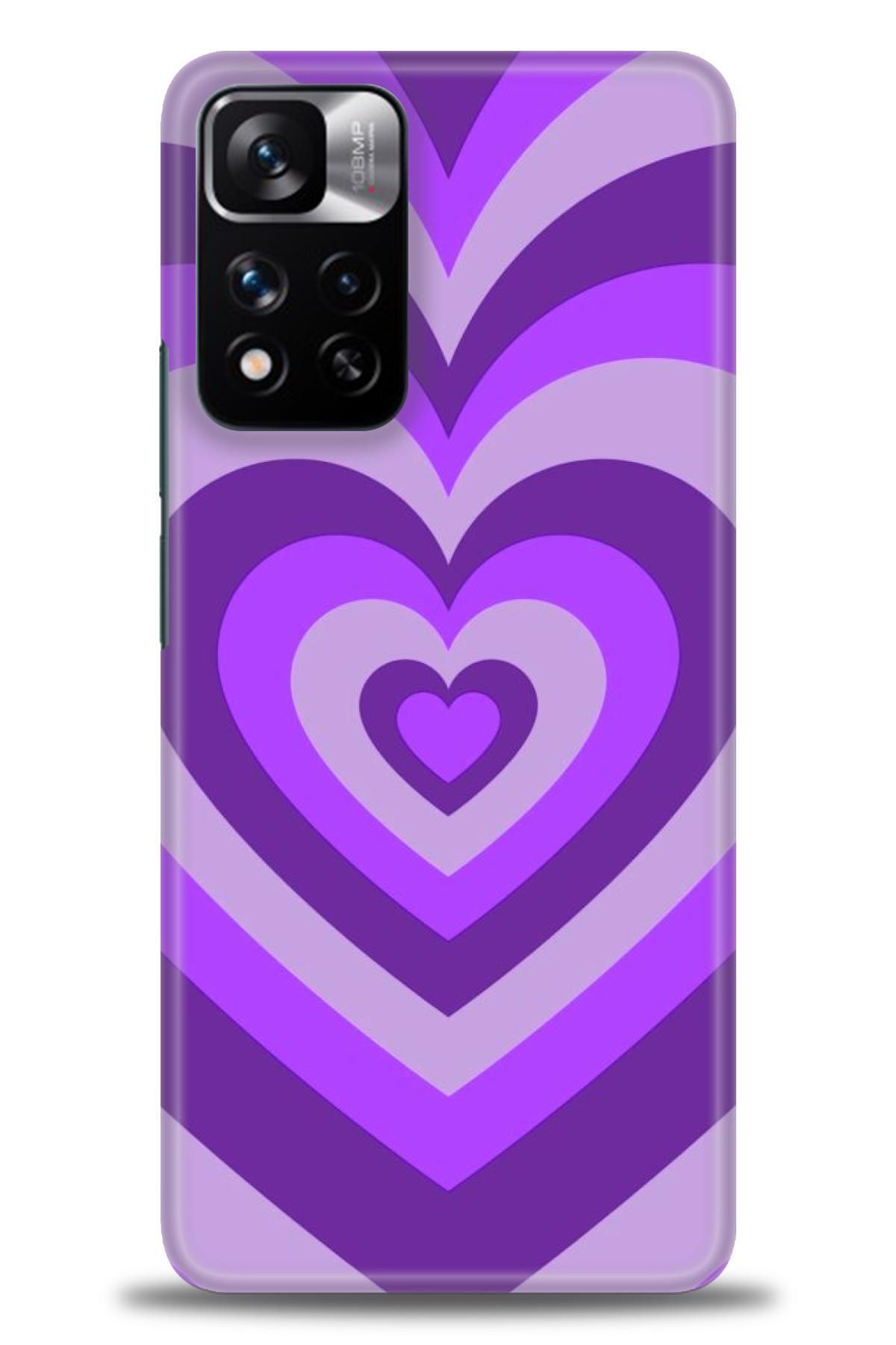 CooperTech Xiaomi Redmi Note 11 Pro Plus İle Uyumlu HD Baskılı Desenli Silikon Kılıf - 560