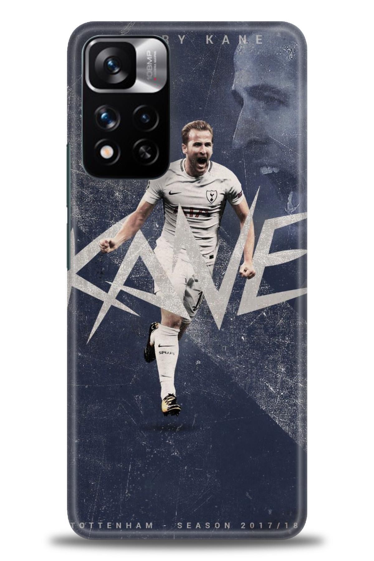 CooperTech Xiaomi Redmi Note 11 Pro Plus İle Uyumlu HD Baskılı Desenli Silikon Kılıf - 141