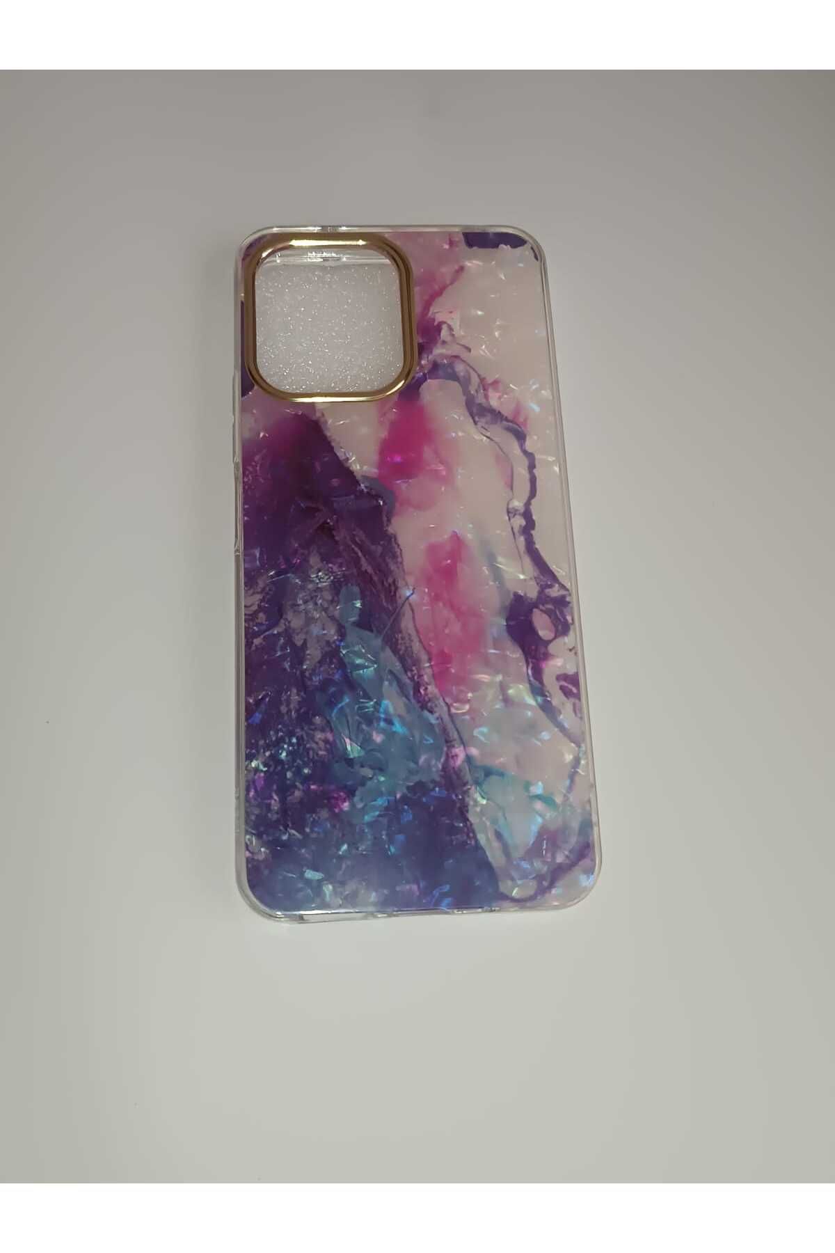 SONADA REDMİ 12 KILIF KAPAK