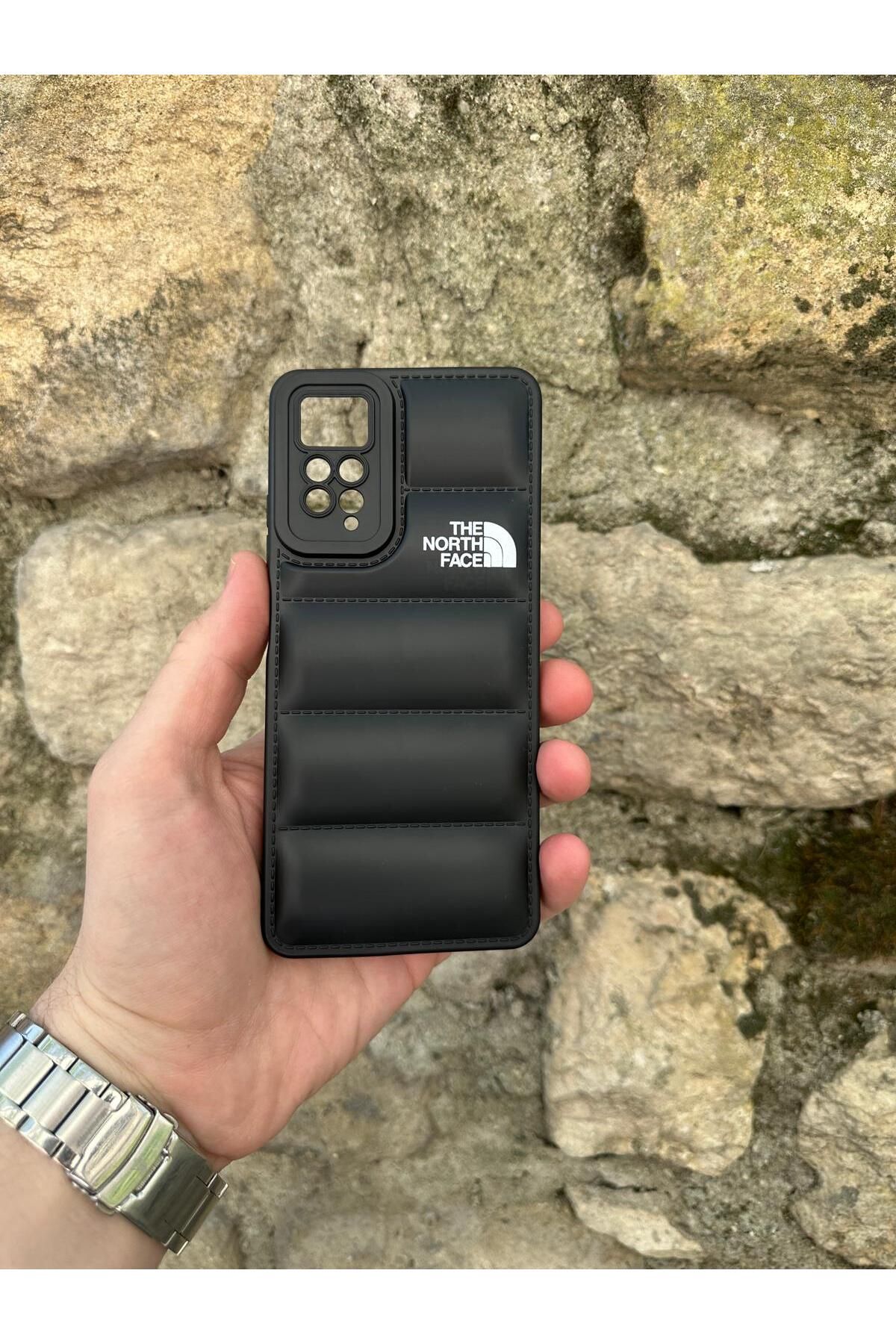 YZGOLDEN XIAOMI NOTE 11 PRO UYUMLU PUFFER CASE TELEFON KILIFI