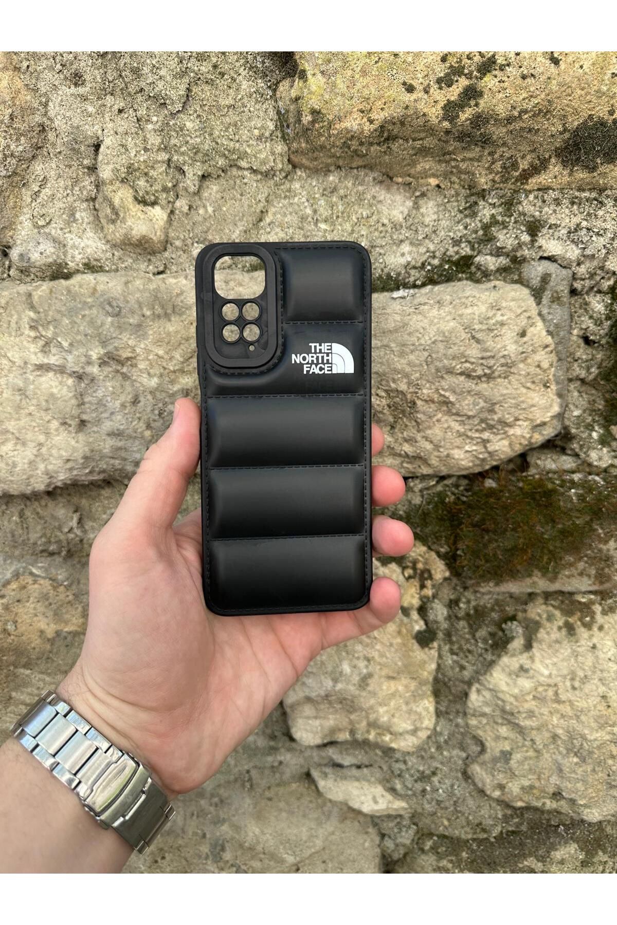 YZGOLDEN XIAOMI NOTE 11 UYUMLU PUFFER CASE TELEFON KILIFI