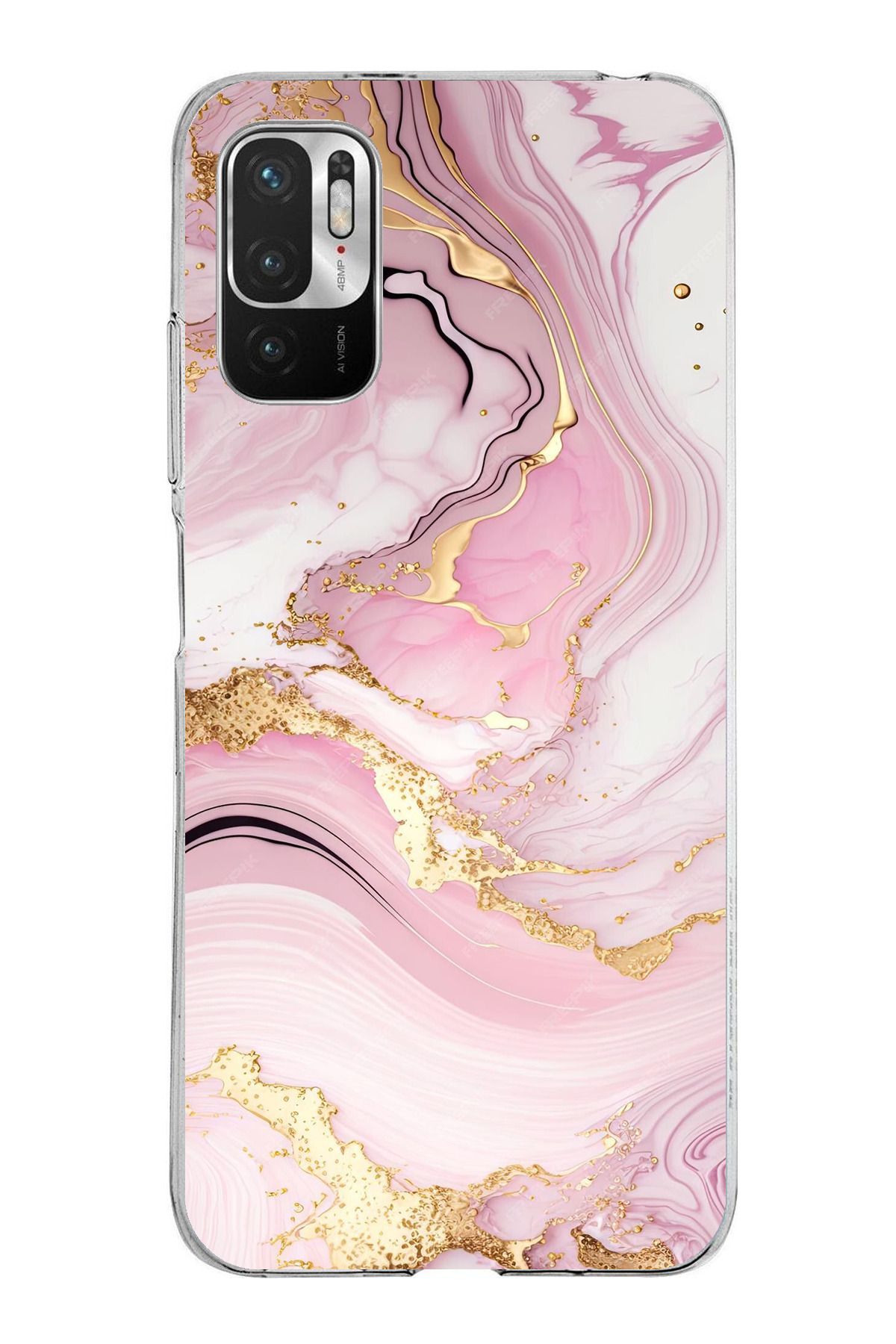 TechTree Redmi Note 10 5G Uyumlu Pembe Mermer Şeffaf Silikon Kılıf