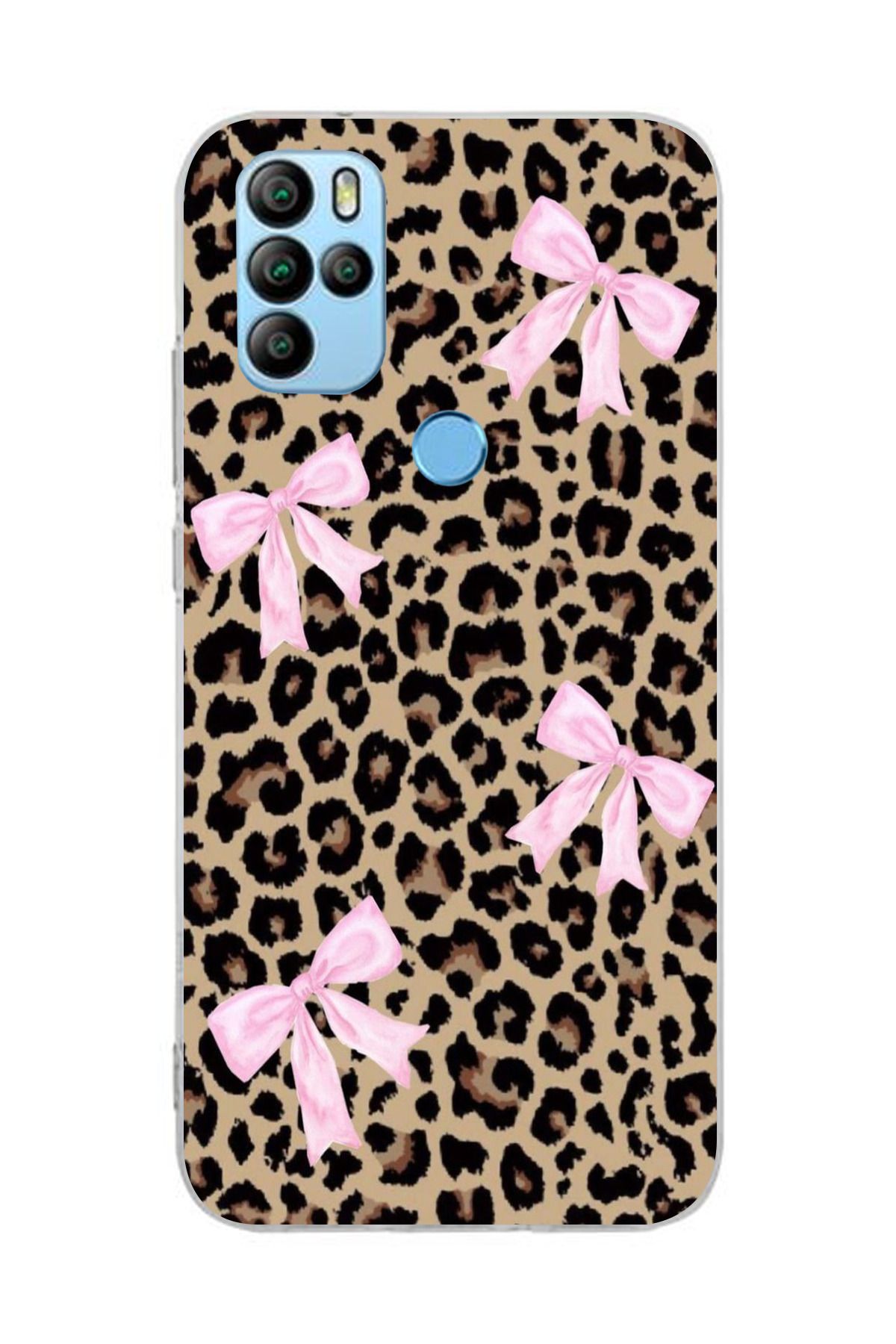 moonset Omix X300/X500 Uyumlu Leopar ve Fiyonk Tasarımlı Baskılı Şeffaf Telefon Kılıfı