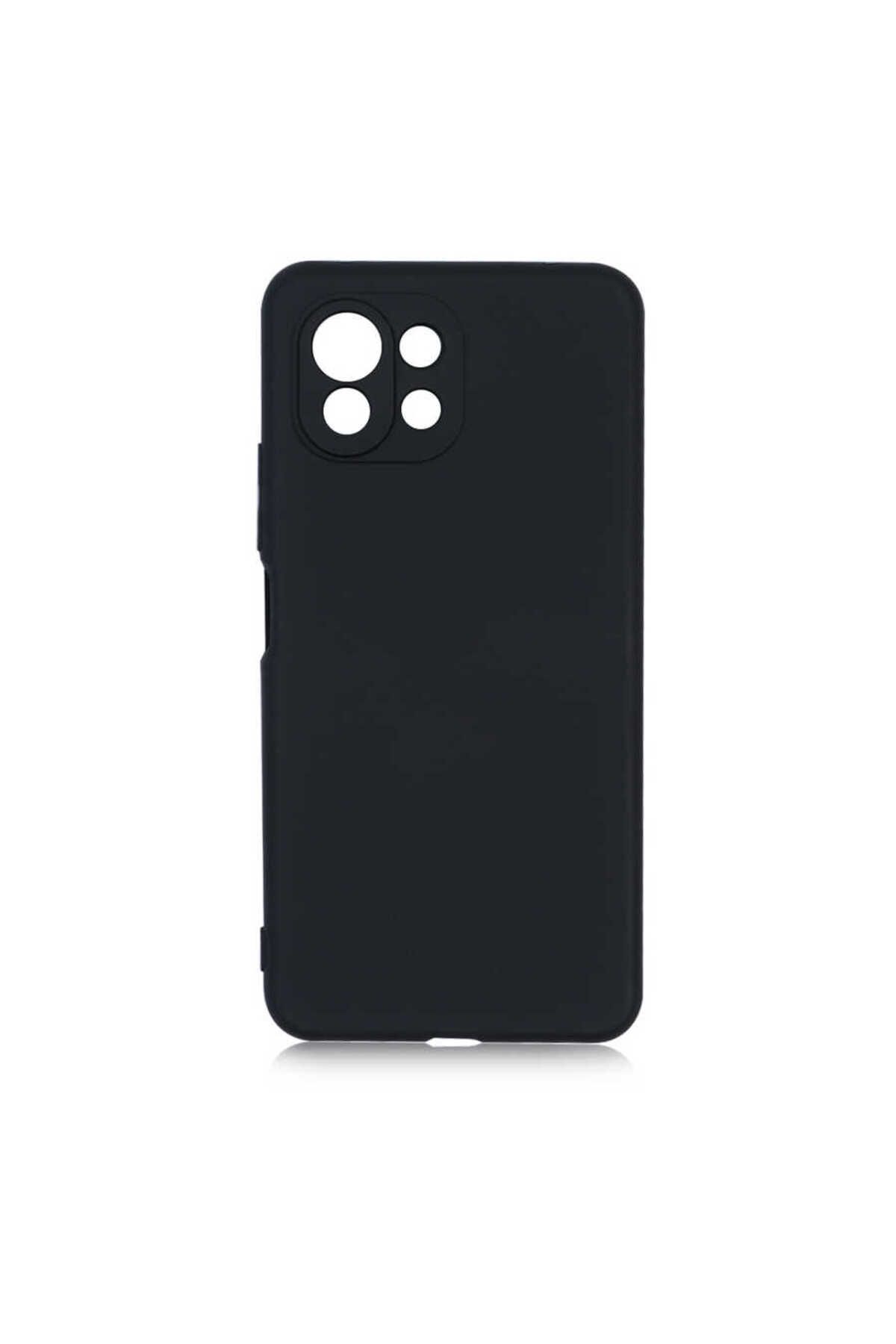Di Aksesuar Xiaomi 11 Lite Siyah Lansman Kılıf