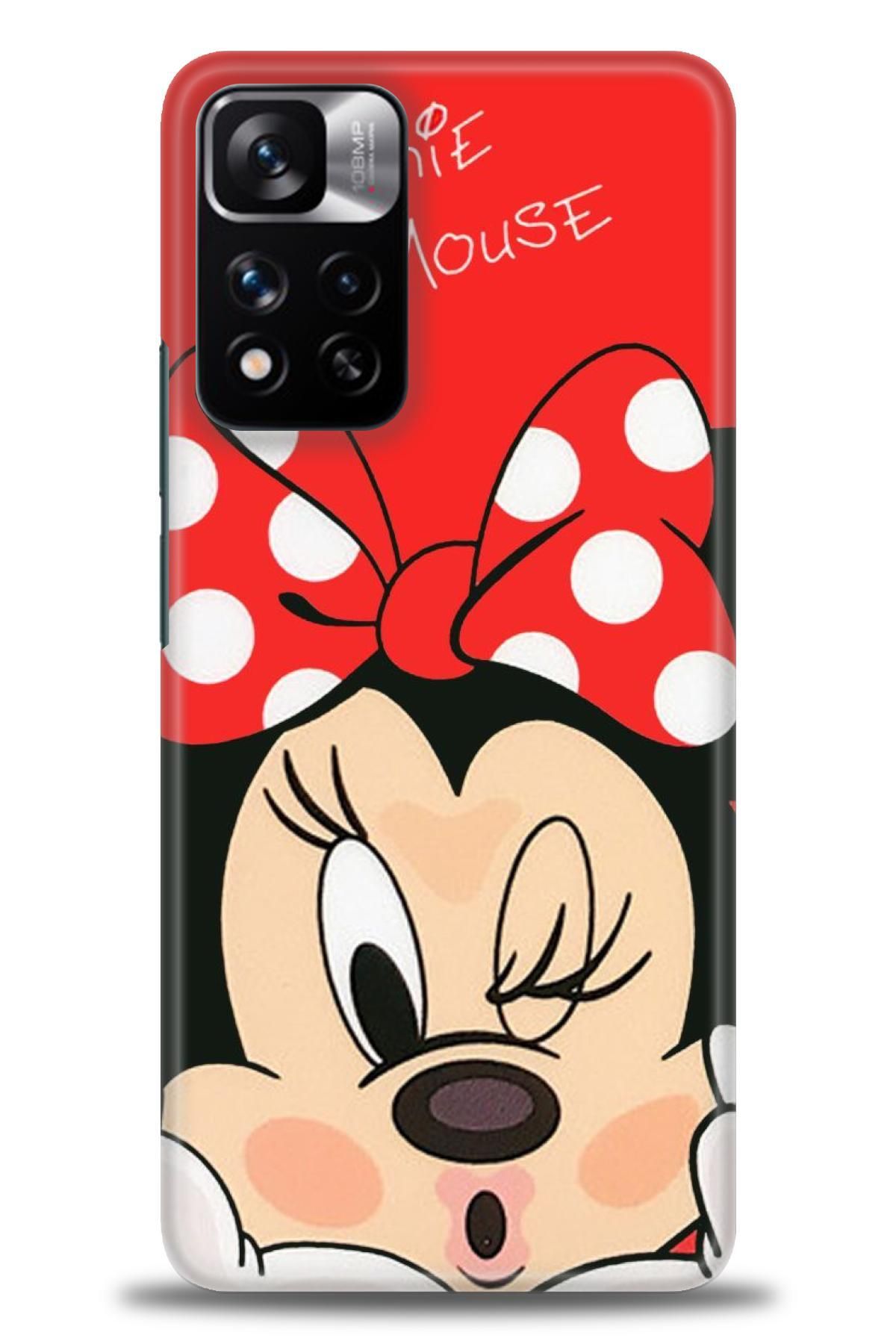 CooperTech Xiaomi Redmi Note 11 Pro Plus İle Uyumlu HD Baskılı Desenli Silikon Kılıf - 671