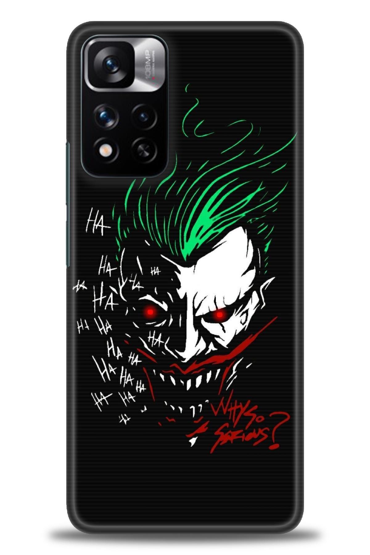 CooperTech Xiaomi Redmi Note 11 Pro Plus İle Uyumlu HD Baskılı Desenli Silikon Kılıf - 431
