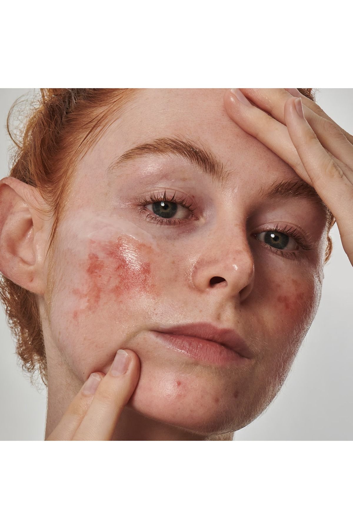 THE INKEY LIST-Redness Solution with 10% Azelaic - Face Serum 30 ml 4
