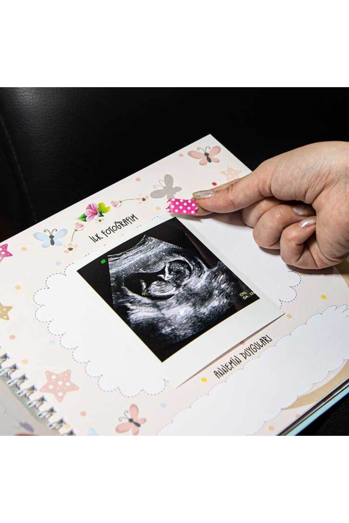 KALE PROMOSYON Hamilelik ve Anne Bebek Günlüğü Mavi, Pembe Renk - Anı Defteri fotoğrafı 2 (önizleme)