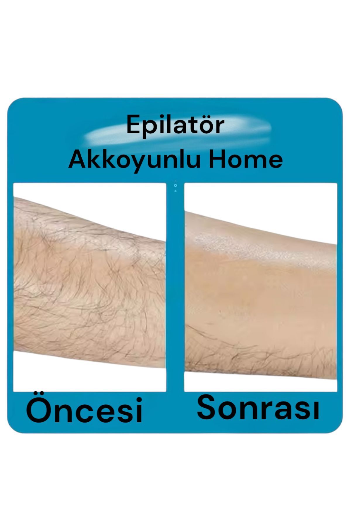 Taşınabilir Epilatör Tüy Kazıyıcı Epilasyon — epilatör — تصویر 2 از 5