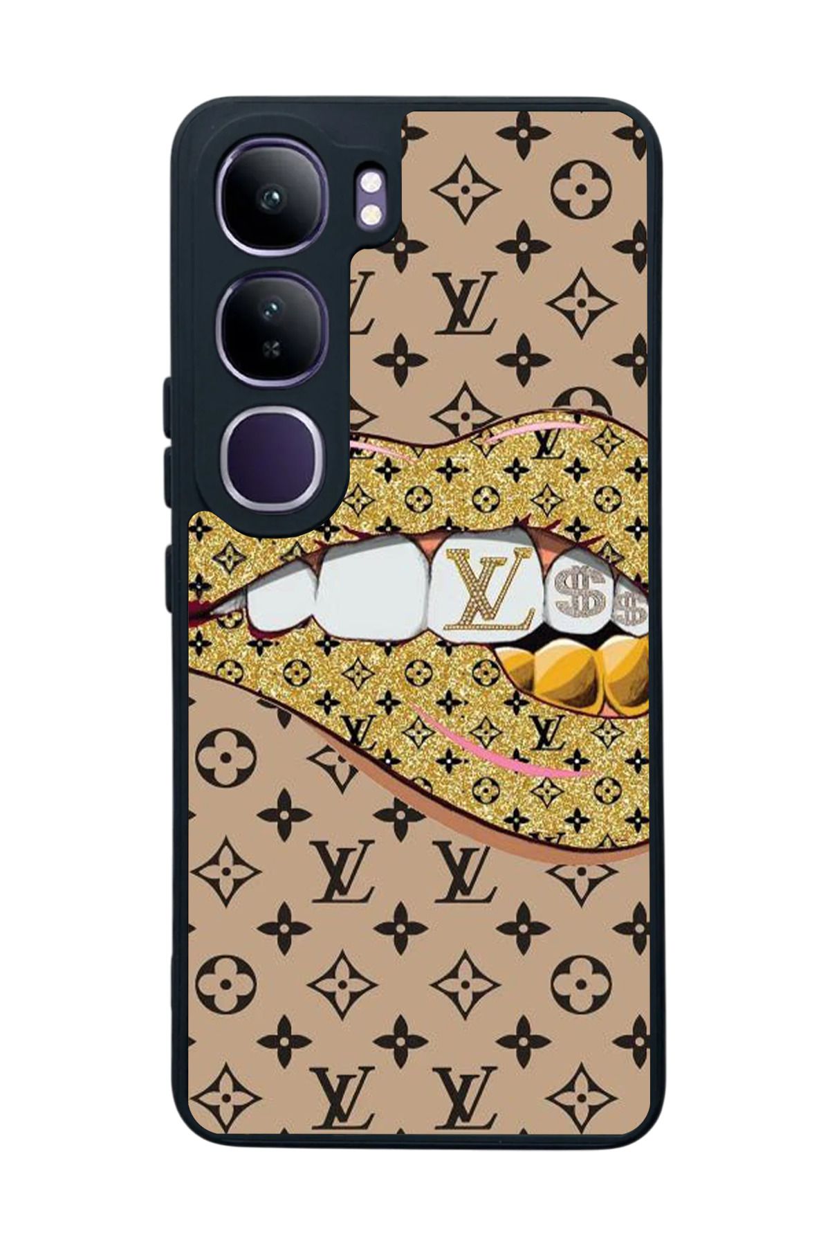 BGAKSESUAR Vivo V40 Lite Uyumlu Mat Siyah Kılıf – Yumuşak Silikon, Koruyucu, Şok Emici Kapak