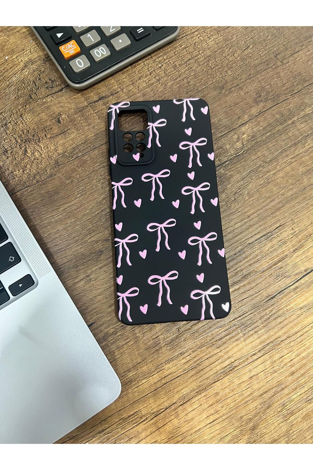 HZR Xiaomi Redmi Note 11 Pro Pembe Kurdele Desenli Siyah Silikon Kılıf