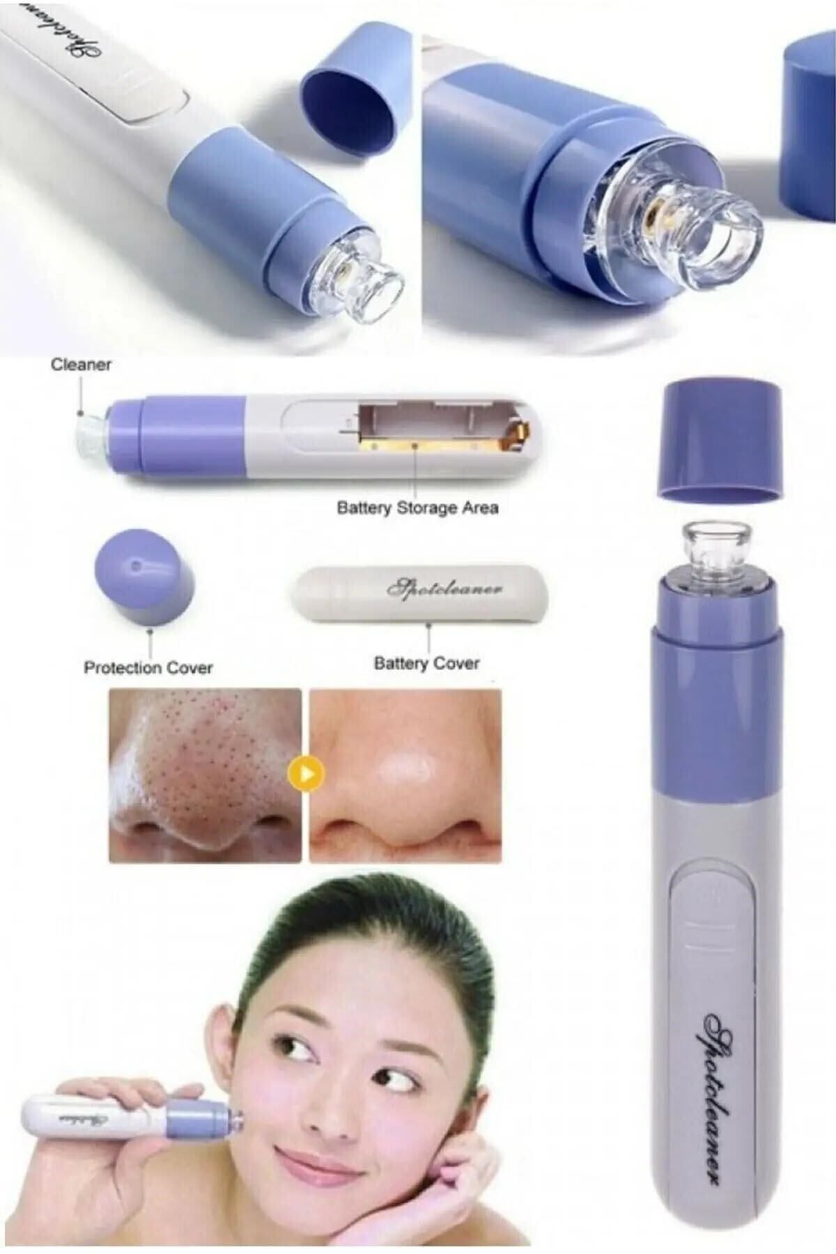KAİZEN Pore Cleaner Vakumlu Yüz Temizleme Siyah Nokta Temizleme Cihazı