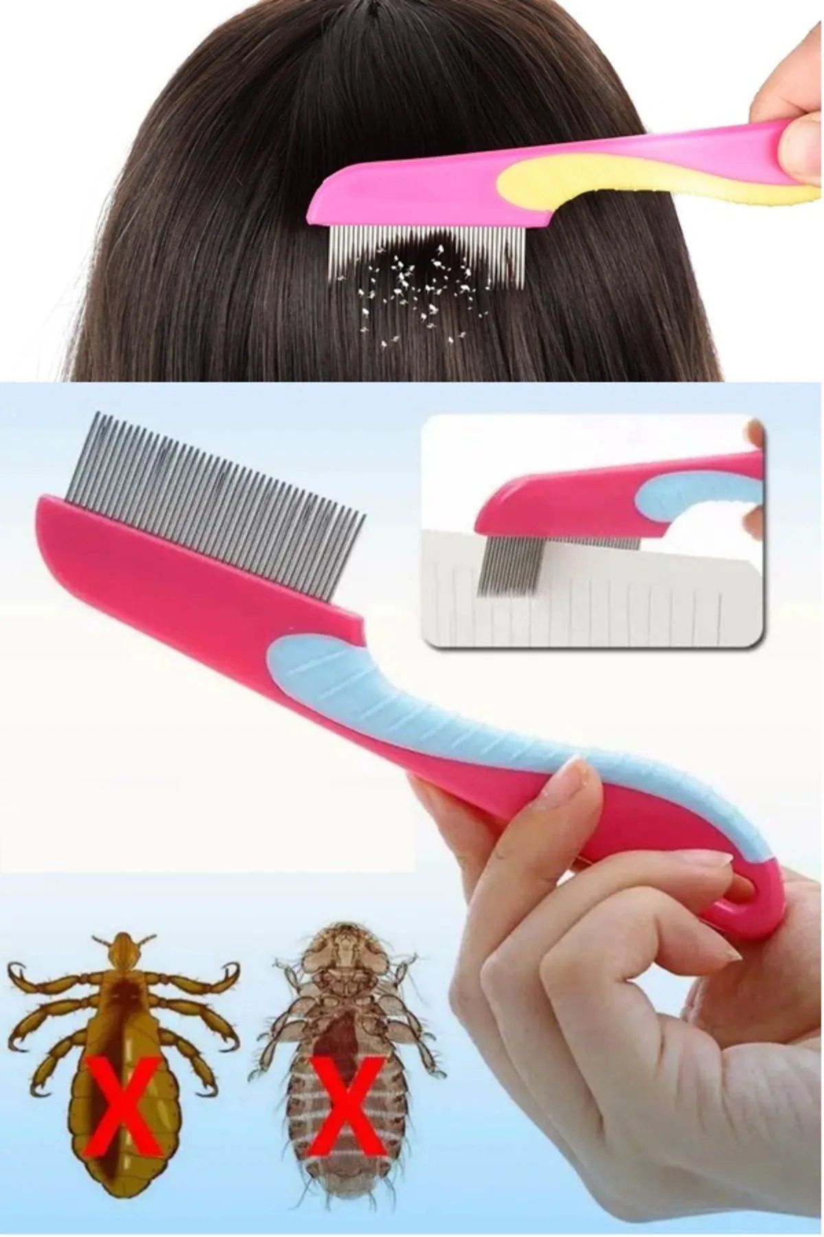CİYU TİCARET Uzun saplı bit tarağı metal dişli bit pire tarağı uzun saplı