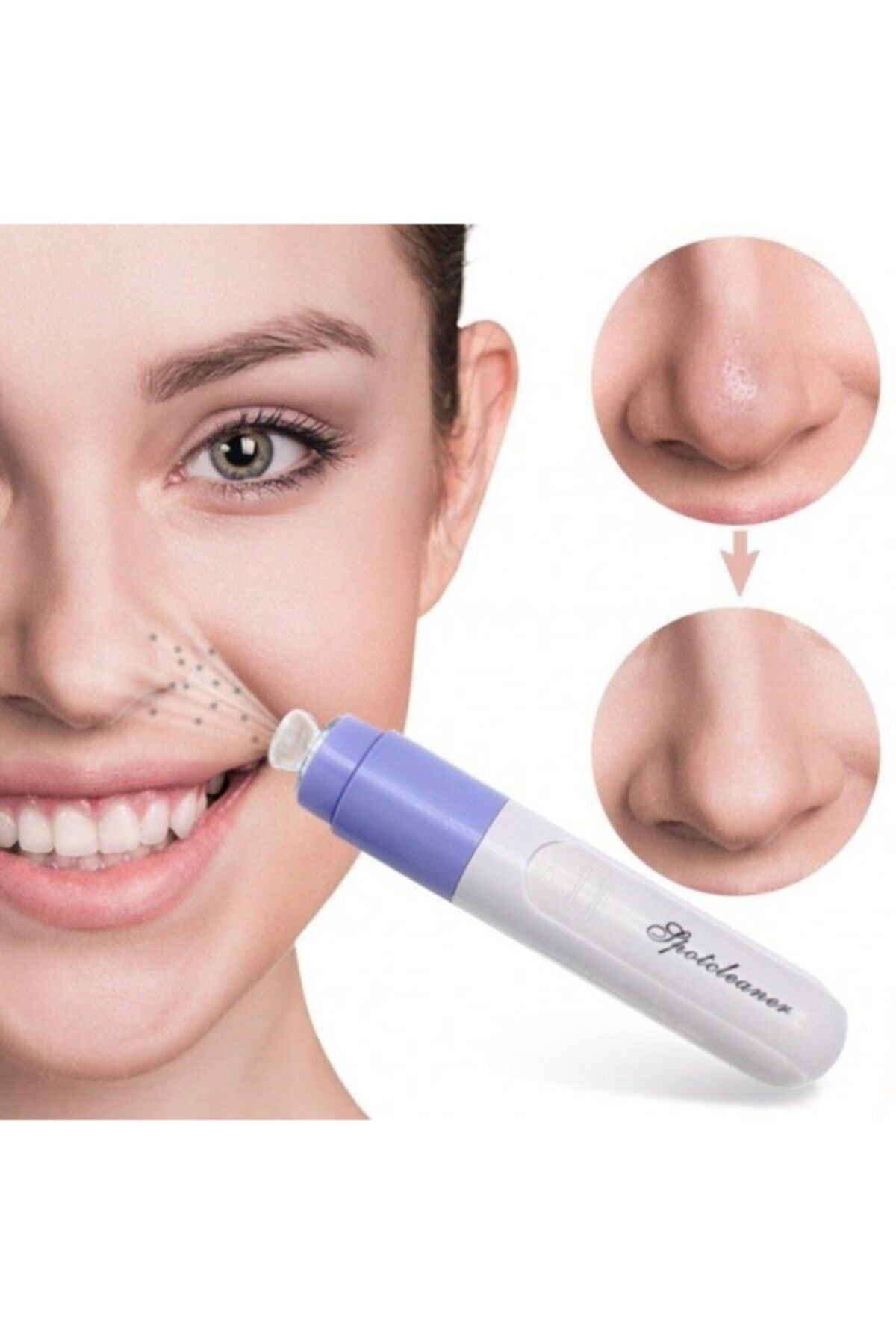 KAİZEN Ğazarız Pore Cleaner Siyah Nokta Temizleme Cihazı