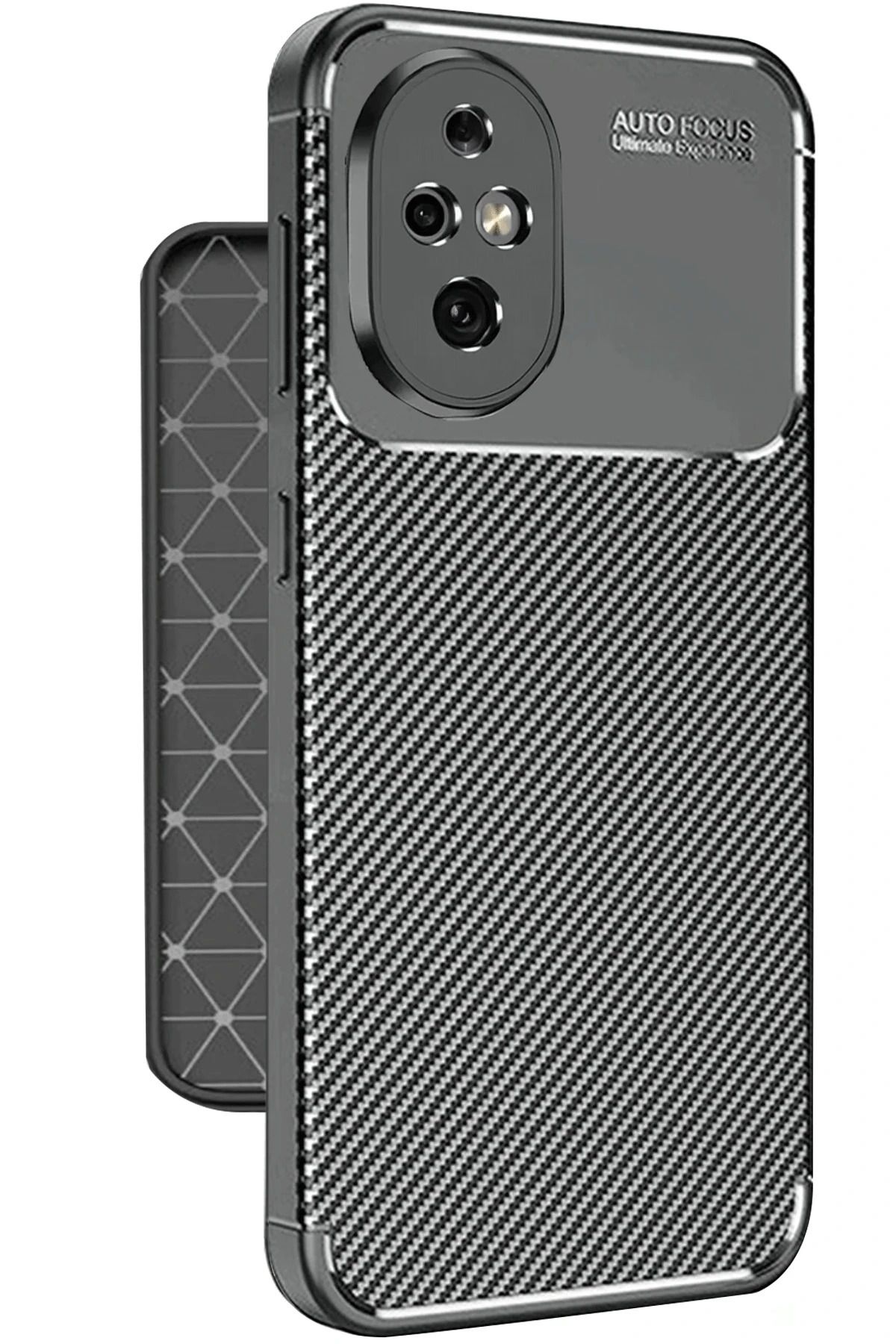 Zipax Honor 200 Kılıf Karbon Görünümlü Silikon Azn-Carbon