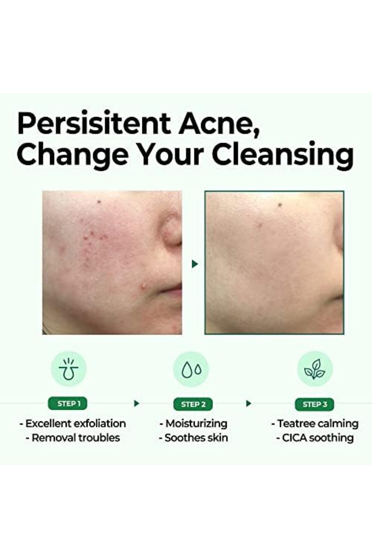Some By Mi-Miracle Bar Soap for Skin Cleansing in 30 Days with AHA, BHA, and PHA from Some By Mi 6