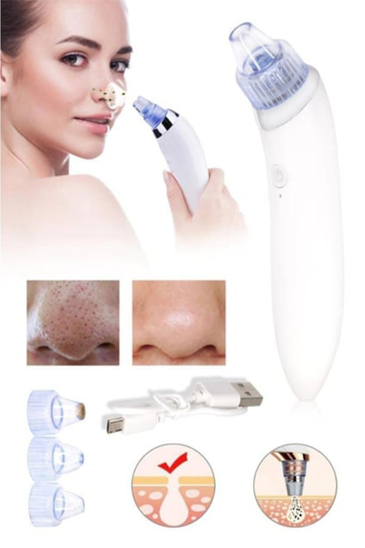 CİYU TİCARET پاک کننده حرفه ای منافذ صورت، پاک کننده پوست، ابزار مکنده، از بین برنده جوش های سرسیاه — AKSİYTEMİZLİ