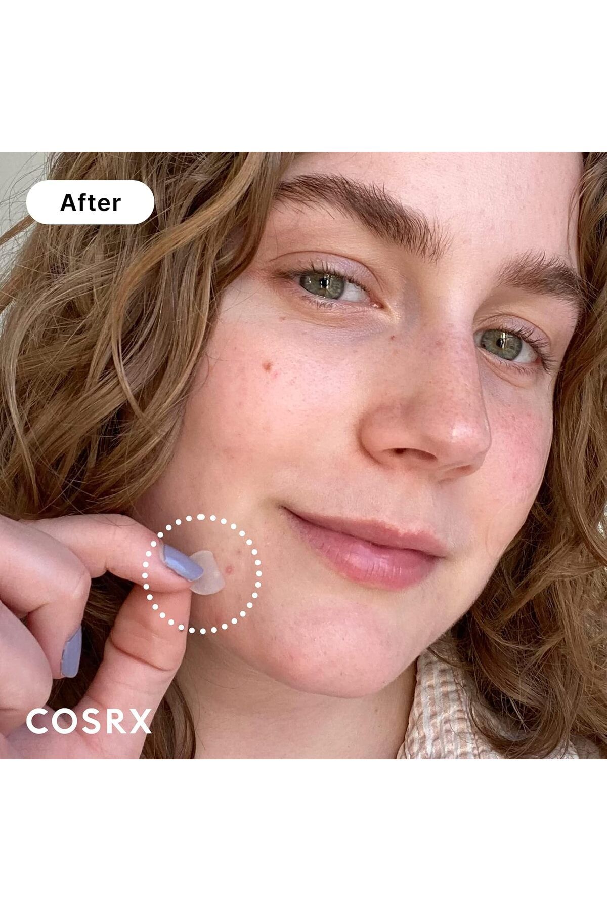 Cosrx-Acne Pimple Patch (96) Absorbing Hydrocolloid Original 3 Size Patches for Blemishes and Zits C 3