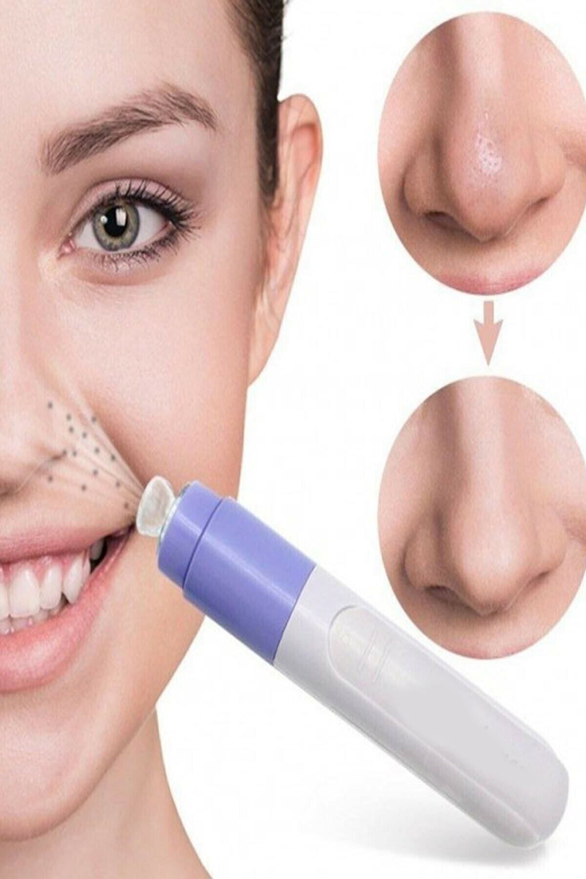 KAİZEN Pore Cleaner Vakumlu Siyah Nokta Yüz Temizleme Cihazı